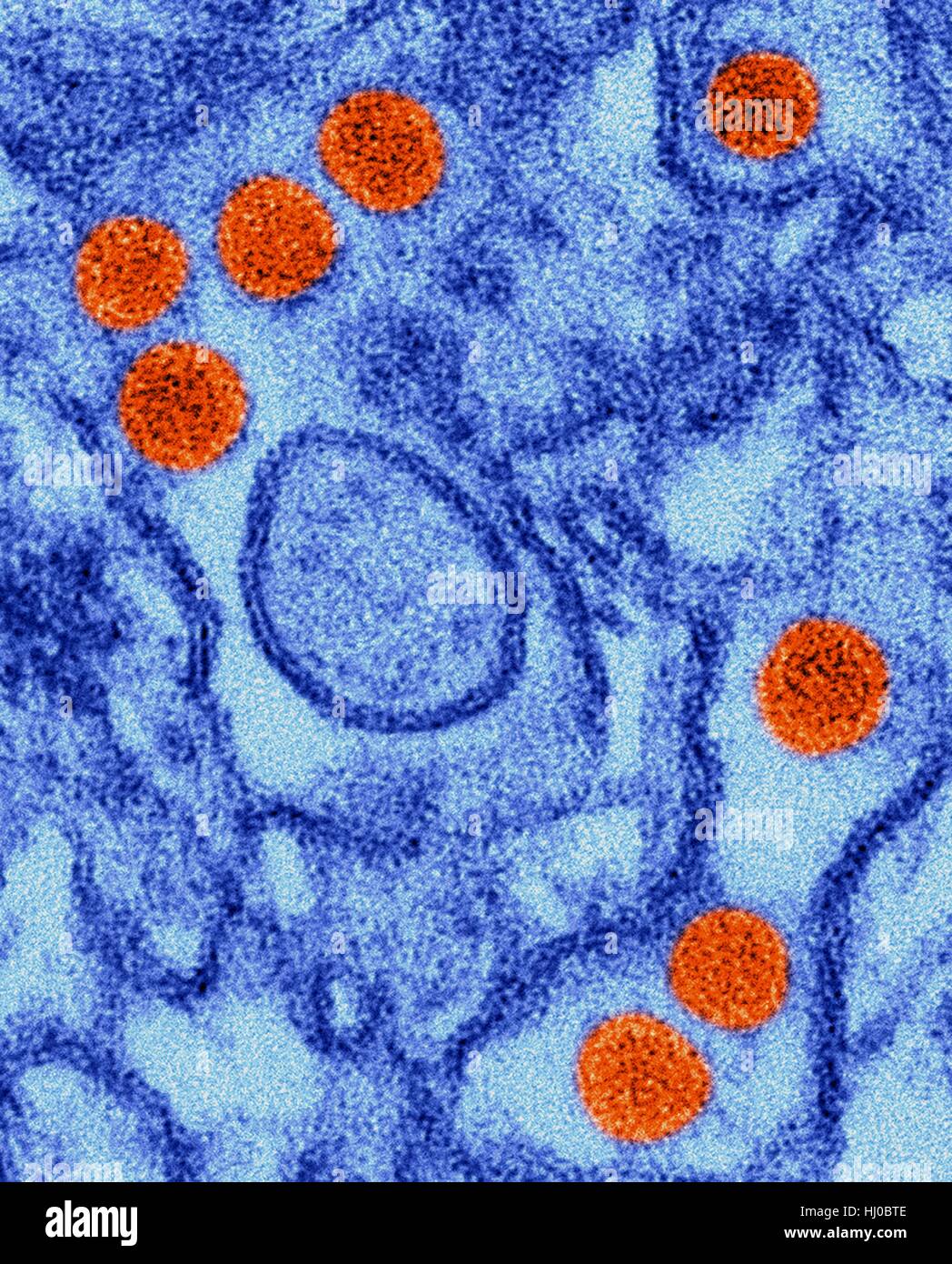 Coloured transmission electron micrograph (TEM) of Zika virus particles (orange) isolated in kidney epithelial cells (Vero E6 cells).Zika viruses have dense core surrounded by envelope (40nm size).Zika virus is RNA (ribonucleic acid) virus in family Flaviviridae causes Zika fever,or Zika Stock Photo