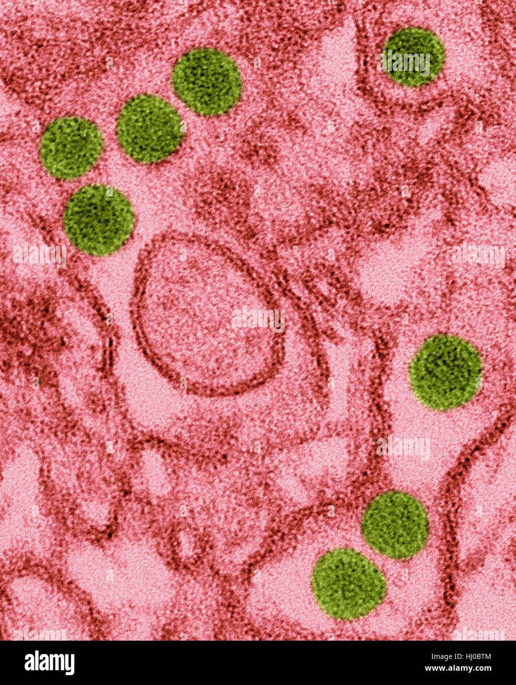 Coloured transmission electron micrograph (TEM) of Zika virus particles (green) isolated in kidney epithelial cells (Vero E6 cells).Zika viruses have dense core surrounded by envelope (40nm size).Zika virus is RNA (ribonucleic acid) virus in family Flaviviridae causes Zika fever,or Zika Stock Photo