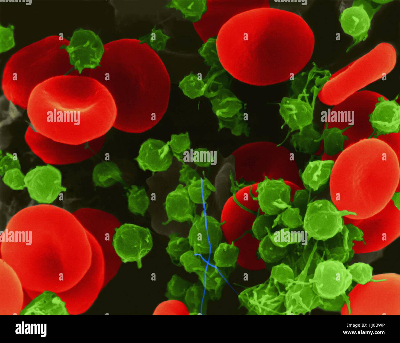Human red blood cells platelets,composite coloured scanning electron micrograph (SEM).Human red blood cells (RBCs),or erythrocytes,are involved in delivering oxygen to body tissue.The cytoplasm of RBCs is rich in haemoglobin,an iron-containing biomolecule that can bind oxygen is responsible for red Stock Photo