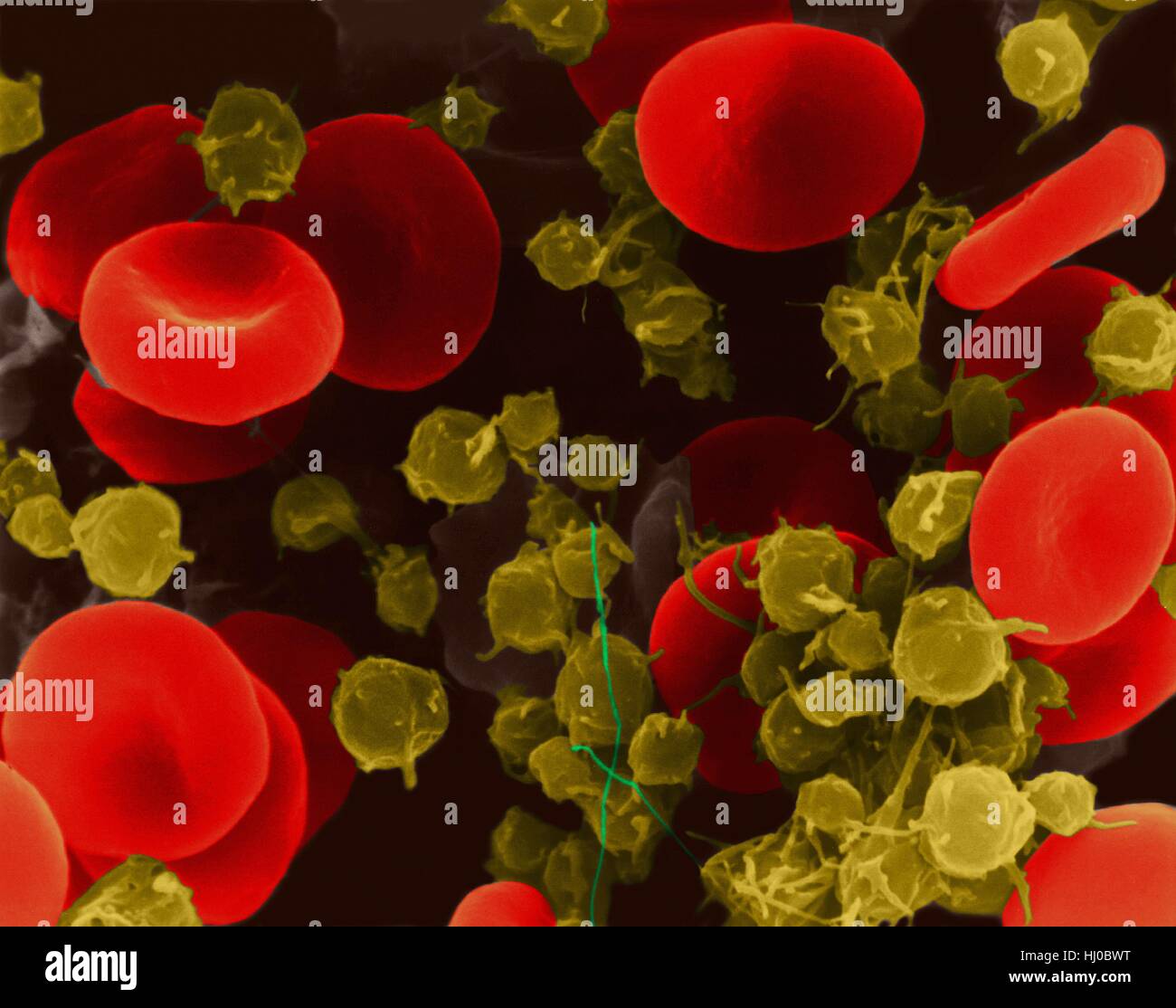 Human red blood cells platelets,coloured scanning electron micrograph  (SEM).Human red blood cells (RBCs),or erythrocytes,are involved in  delivering oxygen to body tissue.The cytoplasm of RBCs is rich in  haemoglobin,an iron-containing biomolecule that can