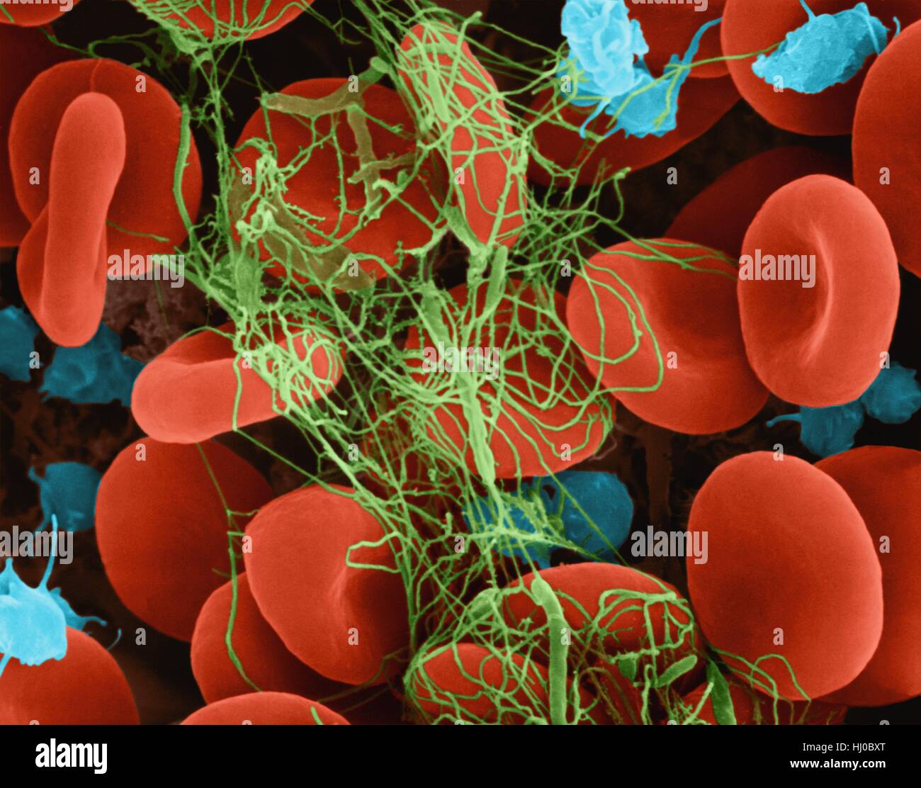 Human red blood cells activated platelets trapped in fibrin blood clot,composite coloured scanning electron micrograph (SEM).Platelets in blood are small oval disks are termed nonactivated platelets or thrombocytes.Platelets serve as body's first line of defence to prevent excessive blood loss.When Stock Photo