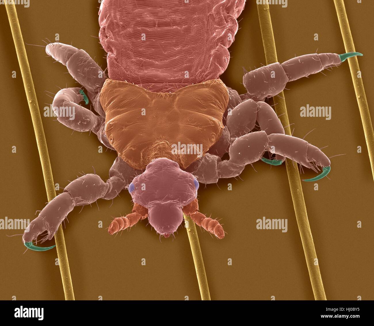 Coloured scanning electron micrograph (SEM) of Human head louse on human hair (Pediculus humanus capitis).The head louse (Pediculus humanus capitis) is insect in Order Psocodea (parasitic lice,formerly Order Phthiraptera/Pscocptera).Head lice are ectoparasites humans as only host.A head louse must Stock Photo