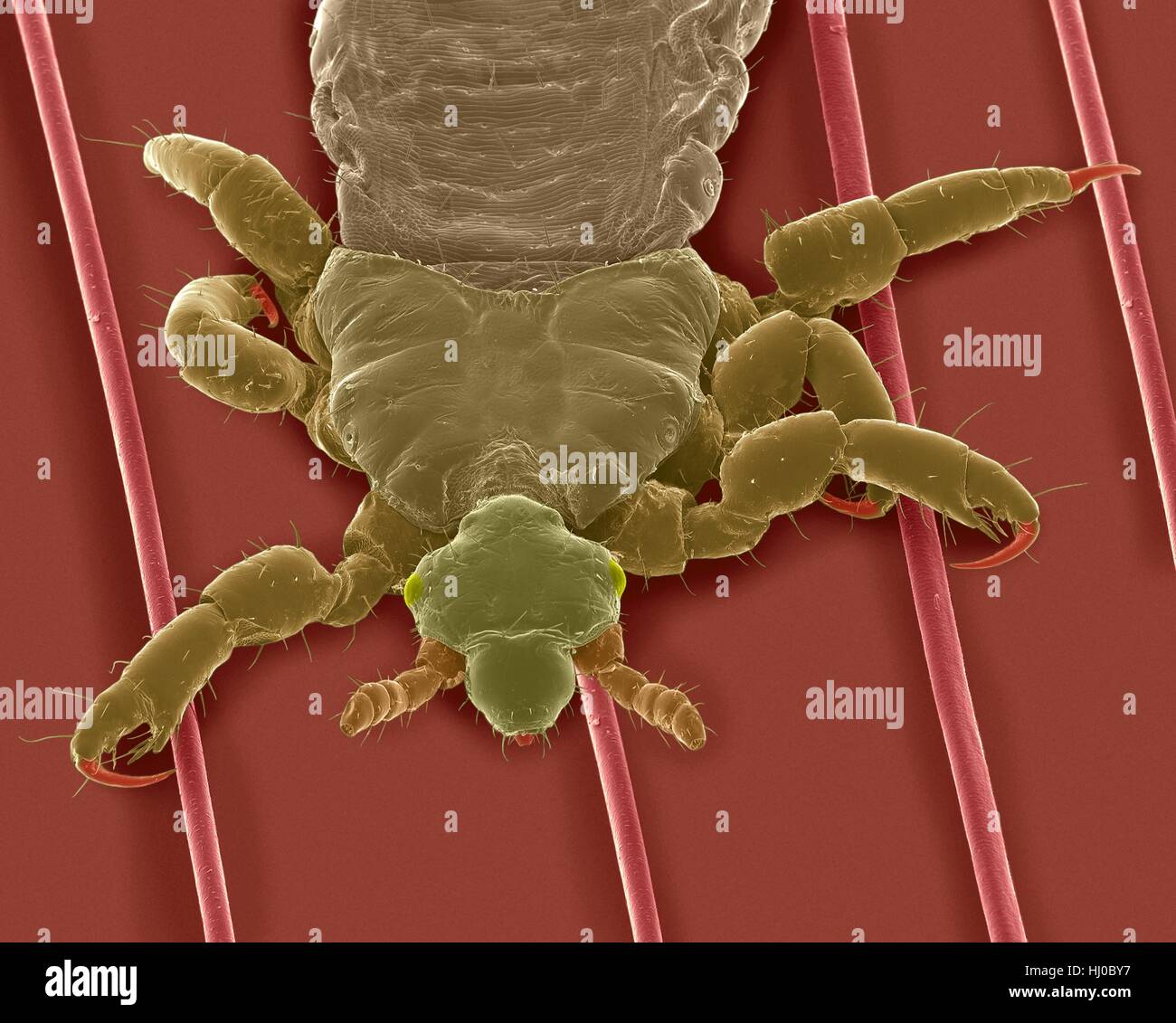 Coloured scanning electron micrograph (SEM) of Human head louse on human hair (Pediculus humanus capitis).The head louse (Pediculus humanus capitis) is insect in Order Psocodea (parasitic lice,formerly Order Phthiraptera/Pscocptera).Head lice are ectoparasites humans as only host.A head louse must Stock Photo