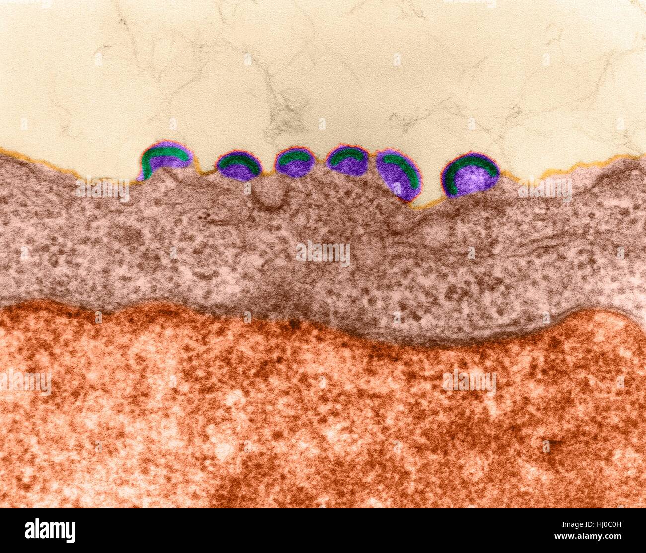 HIV infection,coloured transmission electron micrograph (TEM).Mature virus budding release of HIV in human lymph tissue (RNA virus,Retroviridae Family).In retroviruses nucleocapsid buds directly through cytoplasmic membrane.This produces enveloped virion during release process.HIV (human Stock Photo