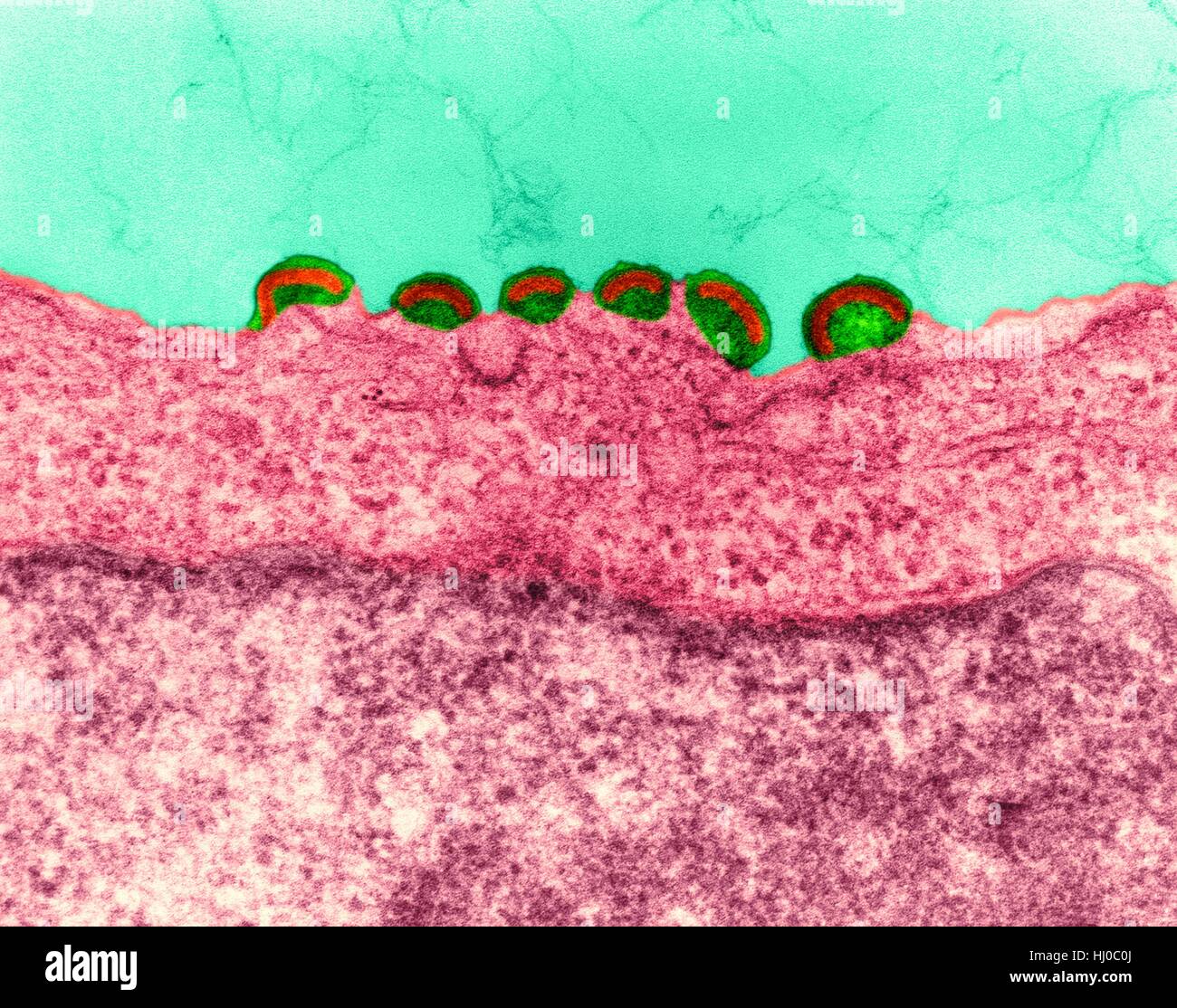 HIV infection,coloured transmission electron micrograph (TEM).Mature virus budding release of HIV in human lymph tissue (RNA virus,Retroviridae Family).In retroviruses nucleocapsid buds directly through cytoplasmic membrane.This produces enveloped virion during release process.HIV (human Stock Photo