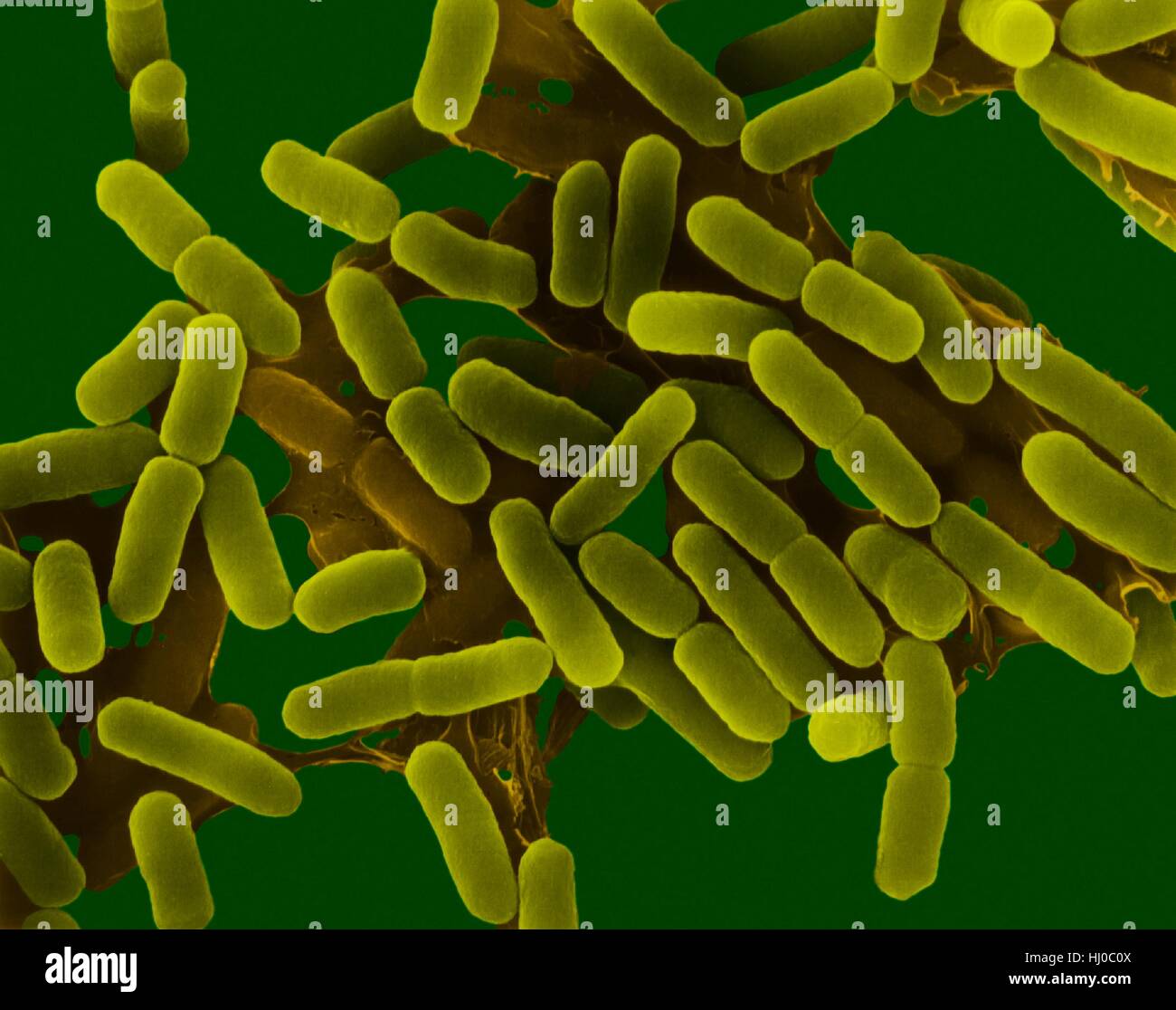 Coloured scanning electron micrograph (SEM) of Escherichia coli is a Gram-negative, facultatively anaerobic, enteric, rod prokaryote. This bacterium was isolated from the human intestine and is normally a part of the human and animal microbiota. Most E. coli strains are harmless, but some strains can cause serious problems such as: food poisoning, urinary tract infections, traveller's diarrhoea and nosocomial infections. The E. coli 0157:H7 strain is fatal to humans if contracted when contaminated meat is cooked inadequately. Magnification: x2, 225 when shortest axis printed at 25 millimetres. Stock Photo