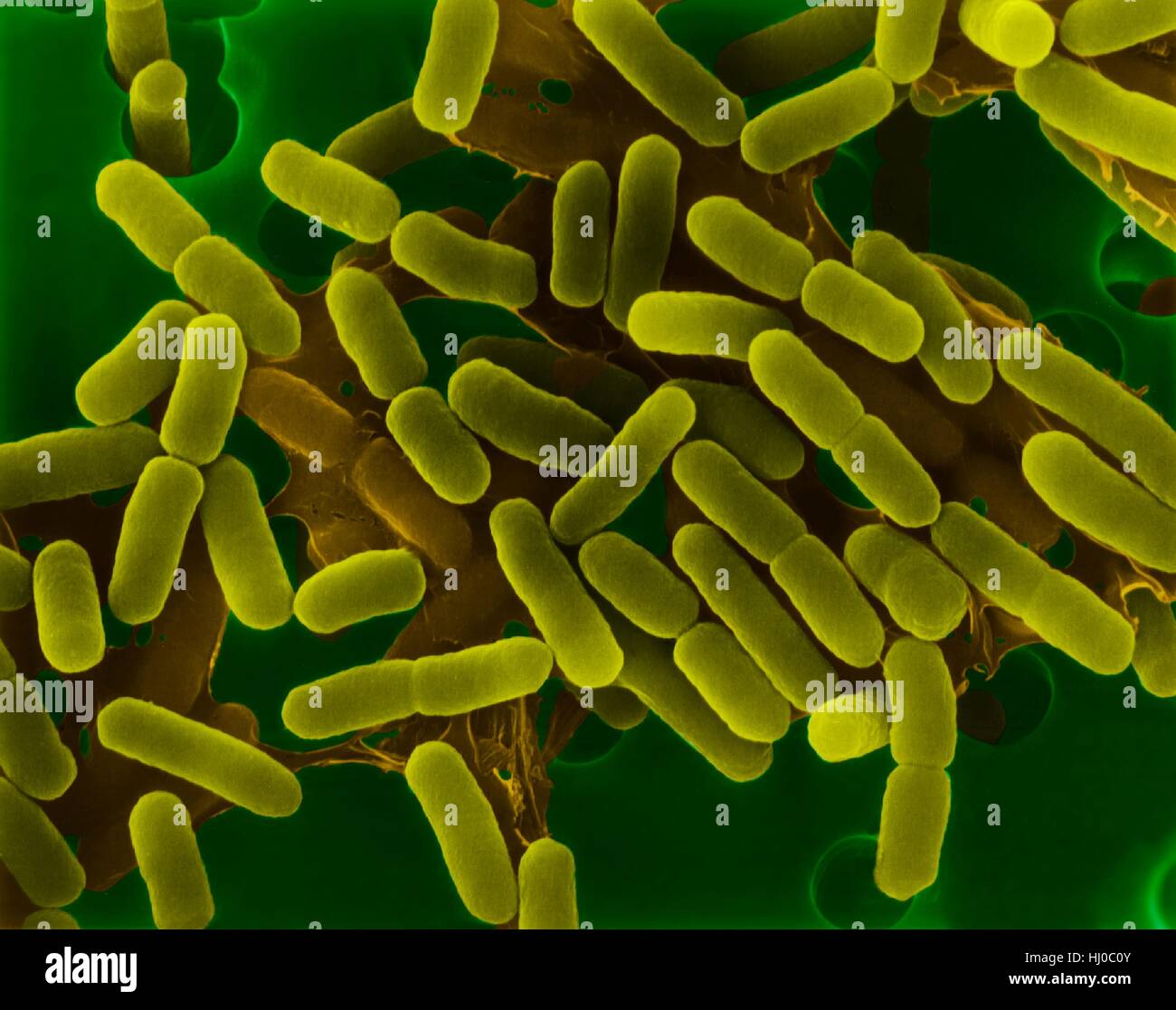 Coloured scanning electron micrograph (SEM) of Escherichia coli is a Gram-negative, facultatively anaerobic, enteric, rod prokaryote. This bacterium was isolated from the human intestine and is normally a part of the human and animal microbiota. Most E. coli strains are harmless, but some strains can cause serious problems such as: food poisoning, urinary tract infections, traveller's diarrhoea and nosocomial infections. The E. coli 0157:H7 strain is fatal to humans if contracted when contaminated meat is cooked inadequately. Magnification: x2, 225 when shortest axis printed at 25 millimetres. Stock Photo