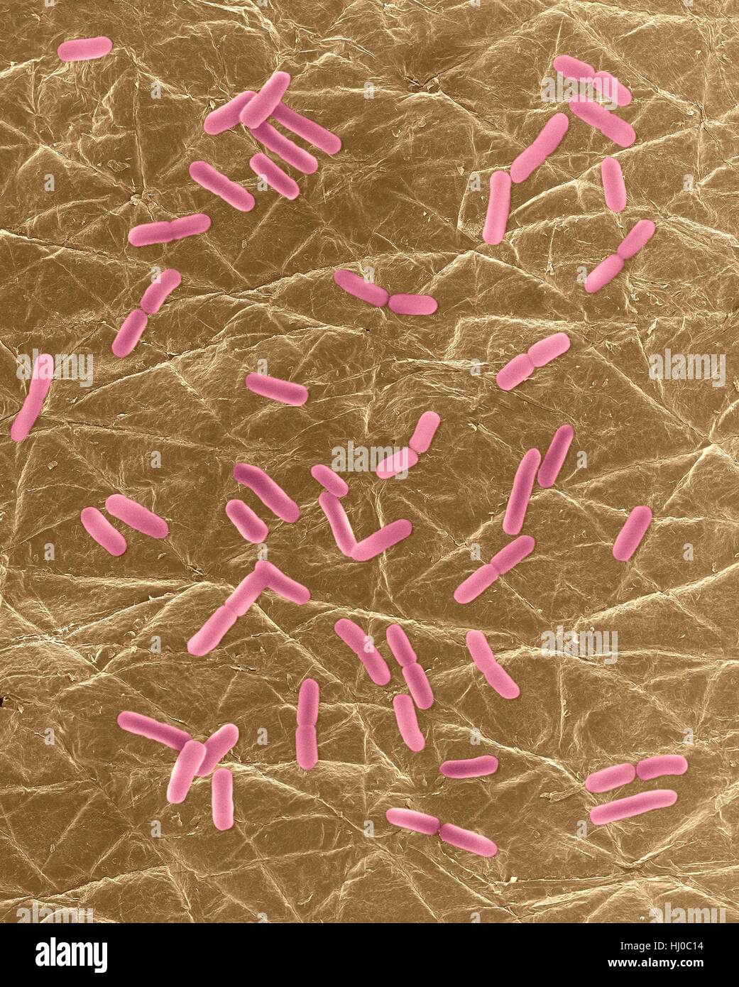 Coloured scanning electron micrograph (SEM) of Photocomposite,E.coli on surface of human skin.Escherichia coli is Gram-negative,facultatively anaerobic,enteric,rod prokaryote.This bacterium is normally part of human animal microbiota.Most E.coli strains are harmless,but some strains can cause serious problems such as: food poisoning,urinary tract infections,traveller's diarrhoea nosocomial infections.The E.coli 0157:H7 strain is fatal to humans if contracted when contaminated meat is cooked inadequately.Magnification: bacteria x800; skin x6 when shortest axis printed at 25 millimetres. Stock Photo