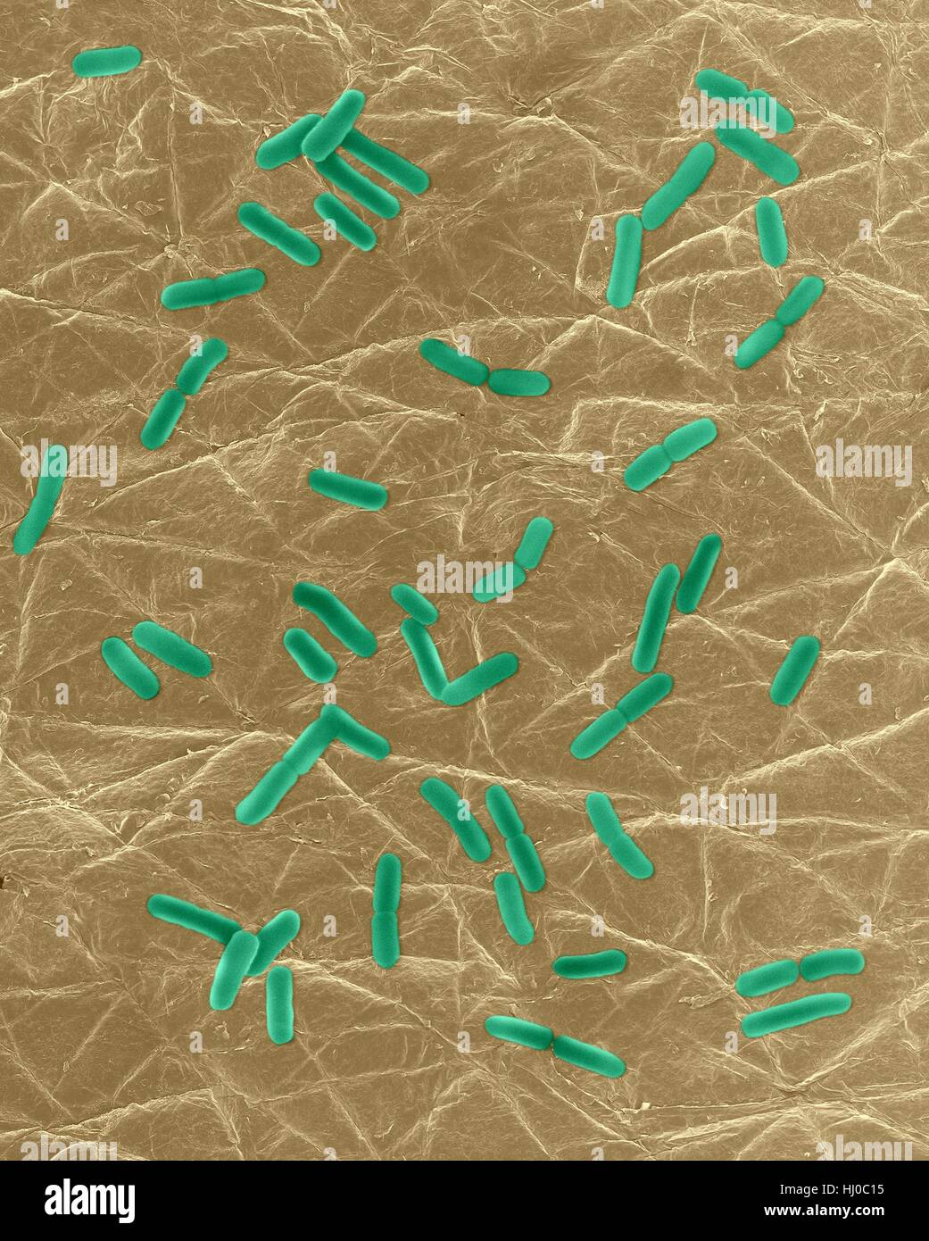 Coloured scanning electron micrograph (SEM) of Photocomposite,E.coli on surface of human skin.Escherichia coli is Gram-negative,facultatively anaerobic,enteric,rod prokaryote.This bacterium is normally part of human animal microbiota.Most E.coli strains are harmless,but some strains can cause serious problems such as: food poisoning,urinary tract infections,traveller's diarrhoea nosocomial infections.The E.coli 0157:H7 strain is fatal to humans if contracted when contaminated meat is cooked inadequately.Magnification: bacteria x800; skin x6 when shortest axis printed at 25 millimetres. Stock Photo