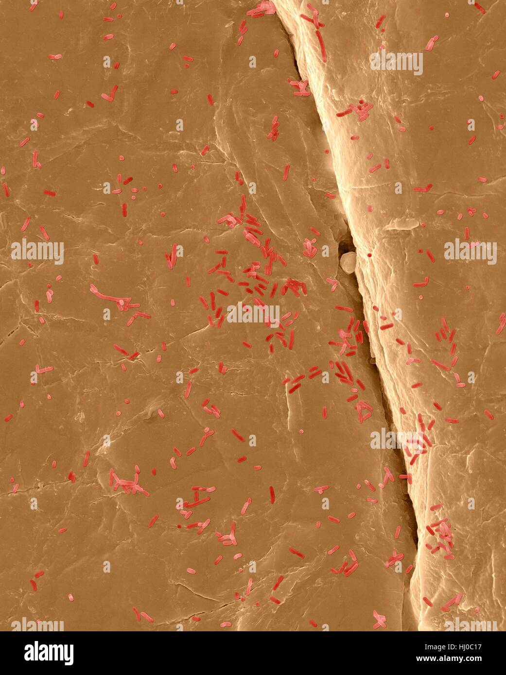 Coloured scanning electron micrograph (SEM) of Photocomposite,E.coli on surface of human skin.Escherichia coli is Gram-negative,facultatively anaerobic,enteric,rod prokaryote.This bacterium is normally part of human animal microbiota.Most E.coli strains are harmless,but some strains can cause serious problems such as: food poisoning,urinary tract infections,traveller's diarrhoea nosocomial infections.The E.coli 0157:H7 strain is fatal to humans if contracted when contaminated meat is cooked inadequately.Magnification: bacteria x200; skin x200 when shortest axis printed at 25 millimetres. Stock Photo