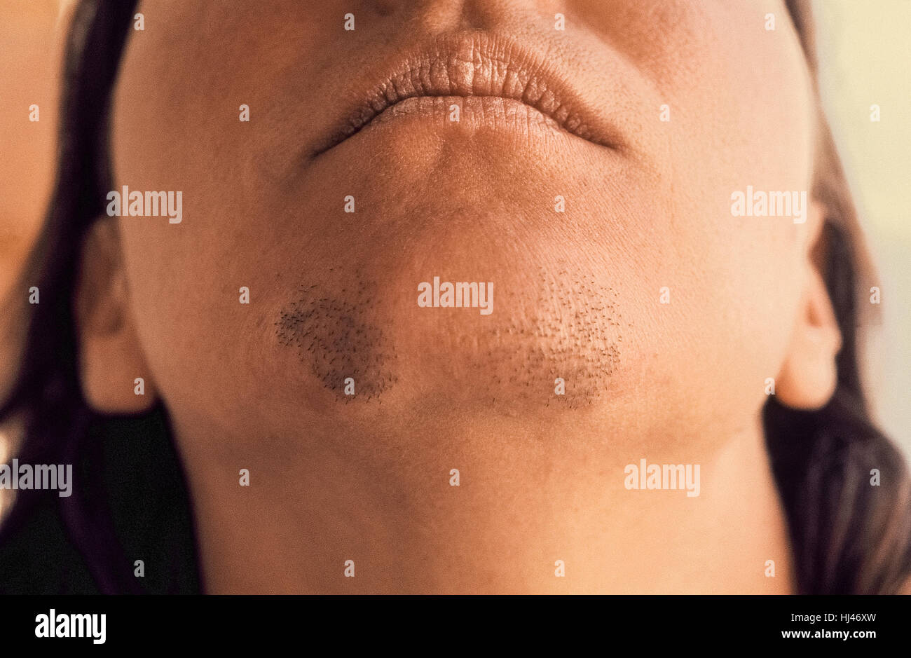A young Caucasian woman shows the unwanted hairs growing from her chin that require depilation or epilation treatment by mechanical or chemical methods in order to remove them. Shaving is the most common way to eliminate these bearded areas but depilatory creams and powders also can be used. More effective is to remove the roots of the hairs by tweezing, waxing, or with drug treatments. Electrolysis is the best way to permanently get rid of unwanted facial hairs. Stock Photo