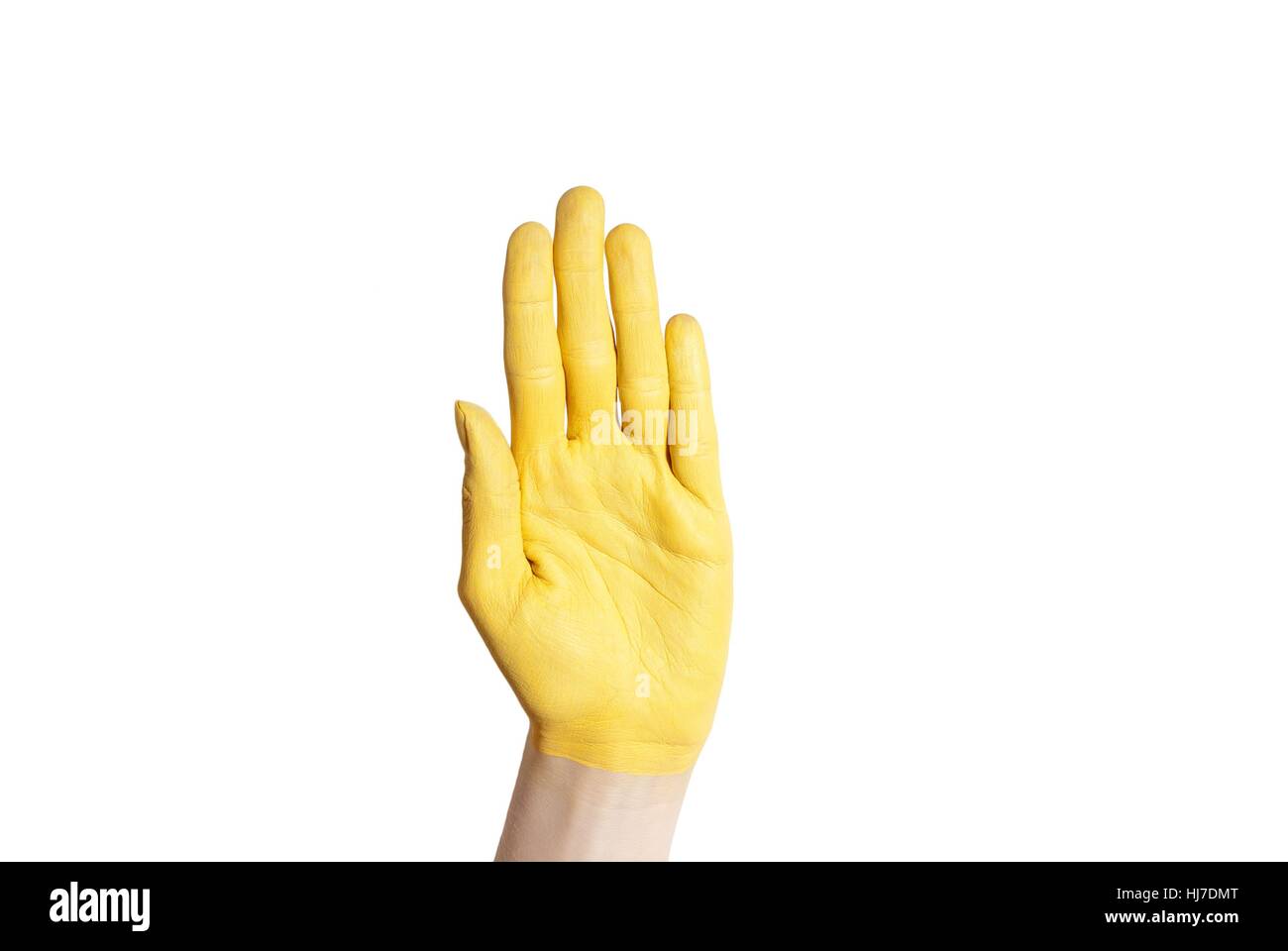 желтоватое пятно на руке. почему рука желтого цвета. пальмарная эритема ладоней. цирроз печени симптомы желтухи. почему рука желтого цвета.