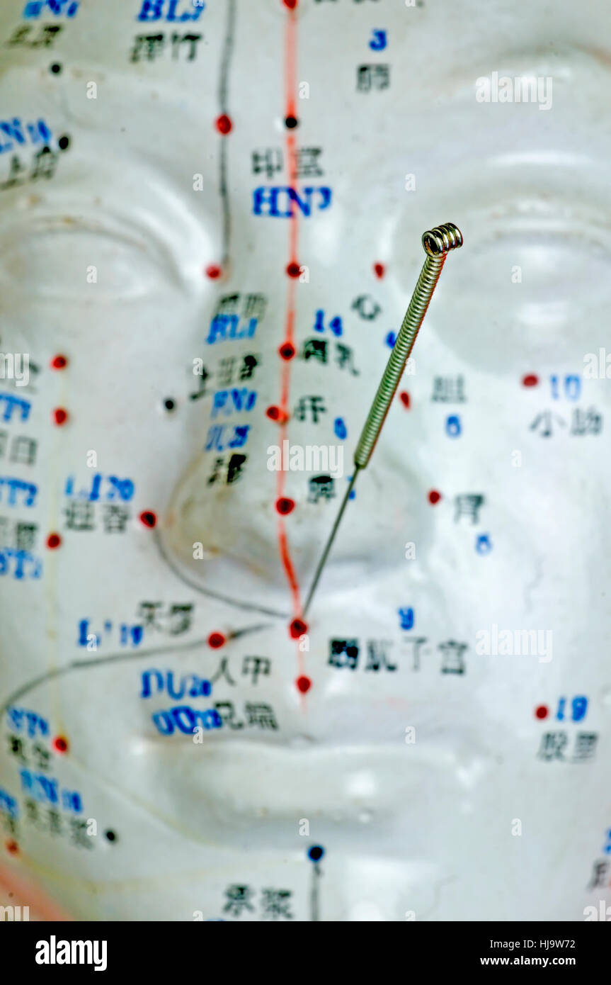 needles, acupuncture, therapy, demonstration, traditional, cure