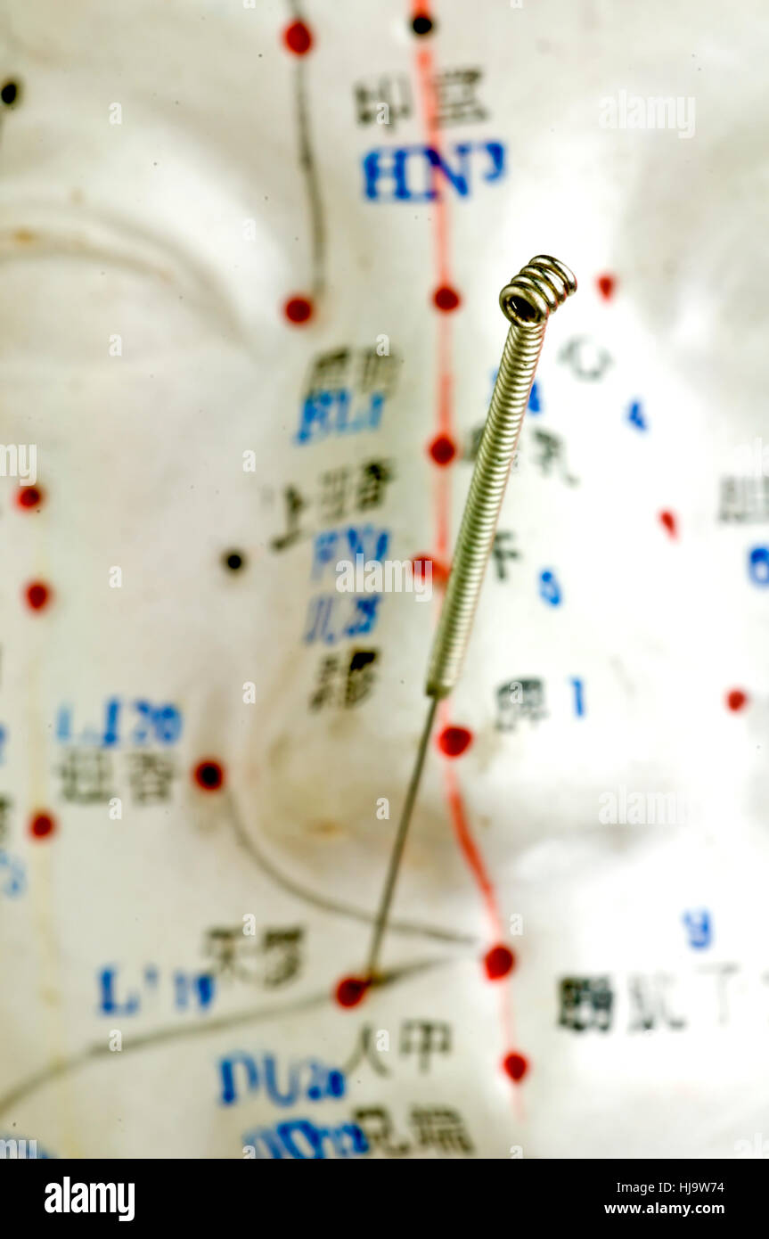 needles, acupuncture, therapy, demonstration, traditional, cure