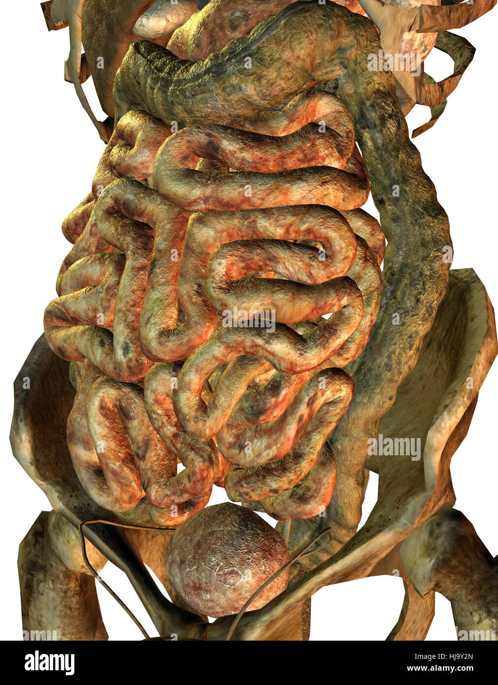 male diseased internal organs Stock Photo