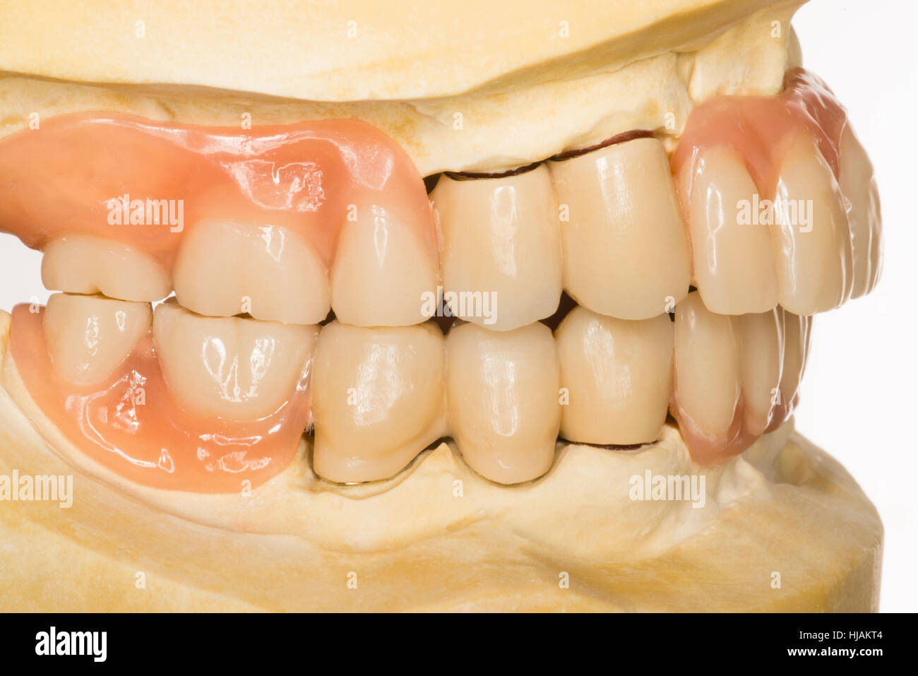 isolated, teeth, bit, dentist, tooth, crown, tooth space, caries