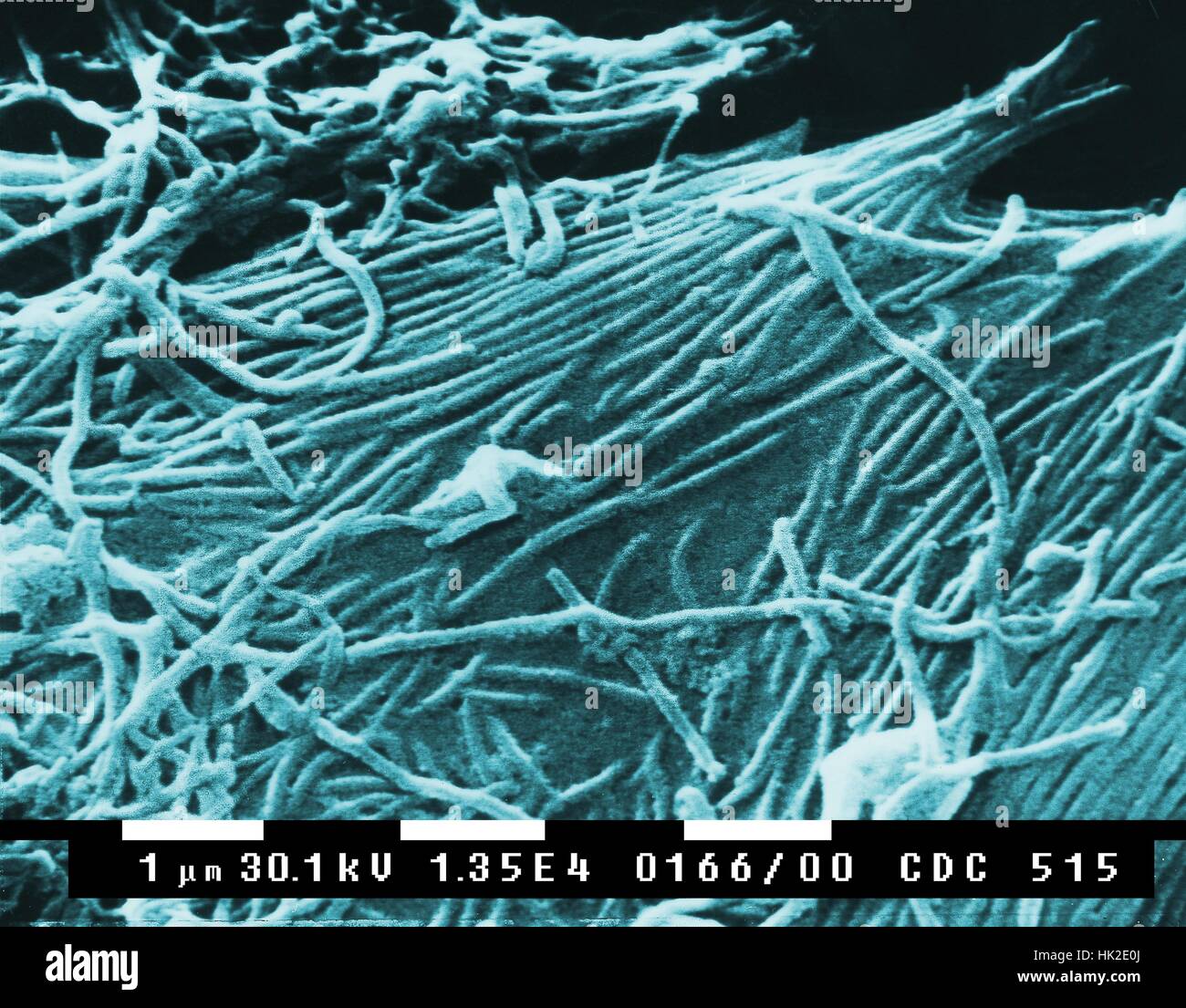 This scanning electron micrograph (SEM) depicts numbers of Ebola virions. Ebola is a severe, often-fatal disease in humans and nonhuman primates (monkeys, gorillas, and chimpanzees) that has appeared sporadically since its initial recognition in 1976. The disease is caused by infection with Ebola virus, named after a river in the Democratic Republic of the Congo (formerly Zaire) in Africa, where it was first recognized. The virus is one of two members of a family of RNA viruses called the Filoviridae. There are four identified subtypes of Ebola virus. Three of the four have caused disease in h Stock Photo