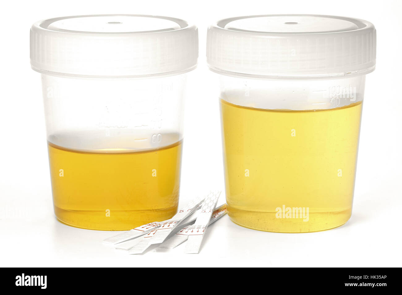 specimen cups for urinalysis with test stripes isolated on white
