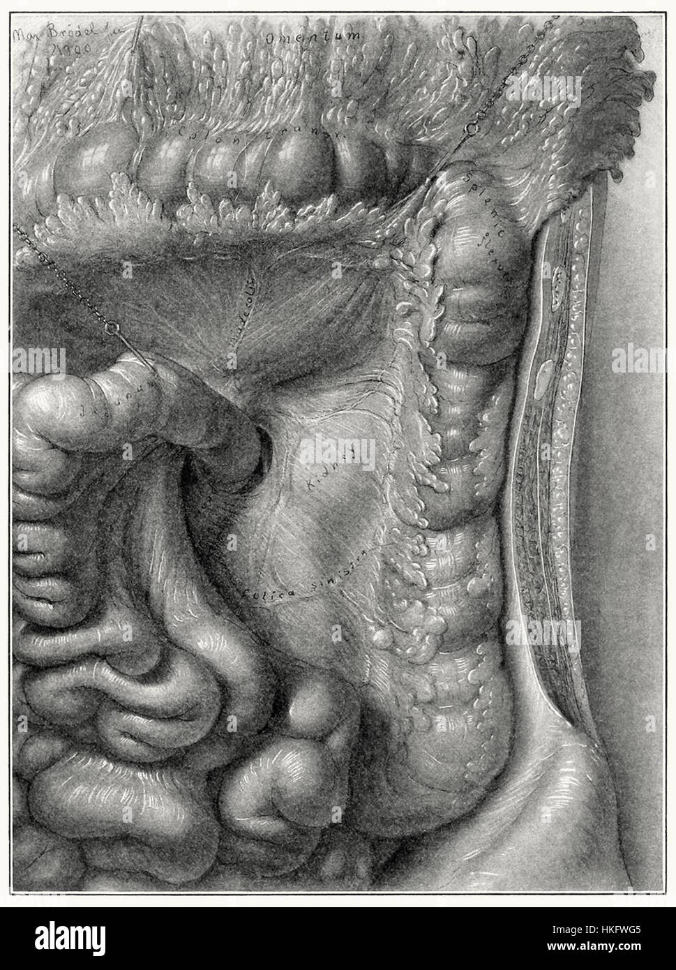 Disc Kidney This detailed anatomical drawing showcases a kidney dissection ...