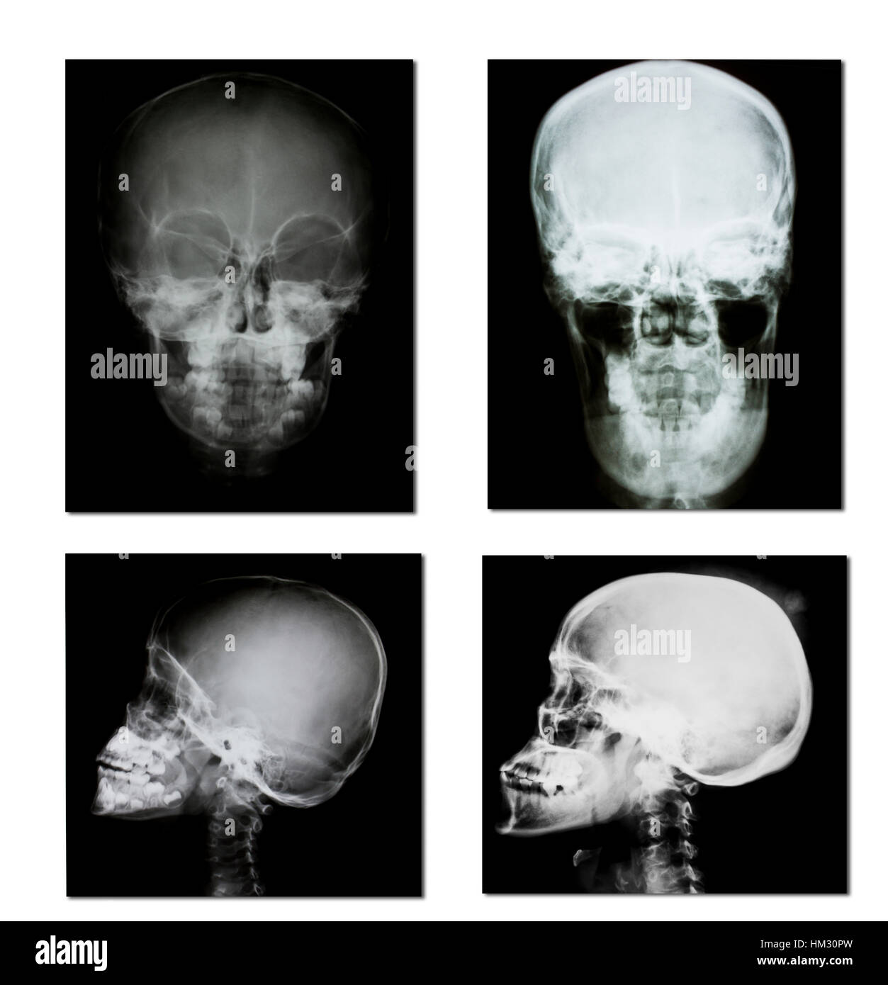 collection of xray (head xray image Stock Photo Alamy