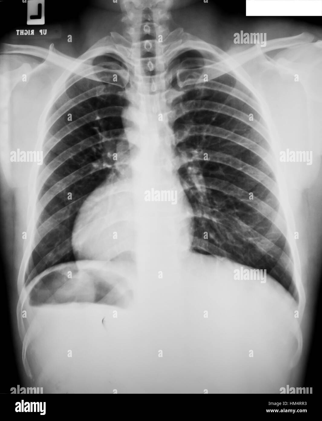 collection of xray Stock Photo Alamy