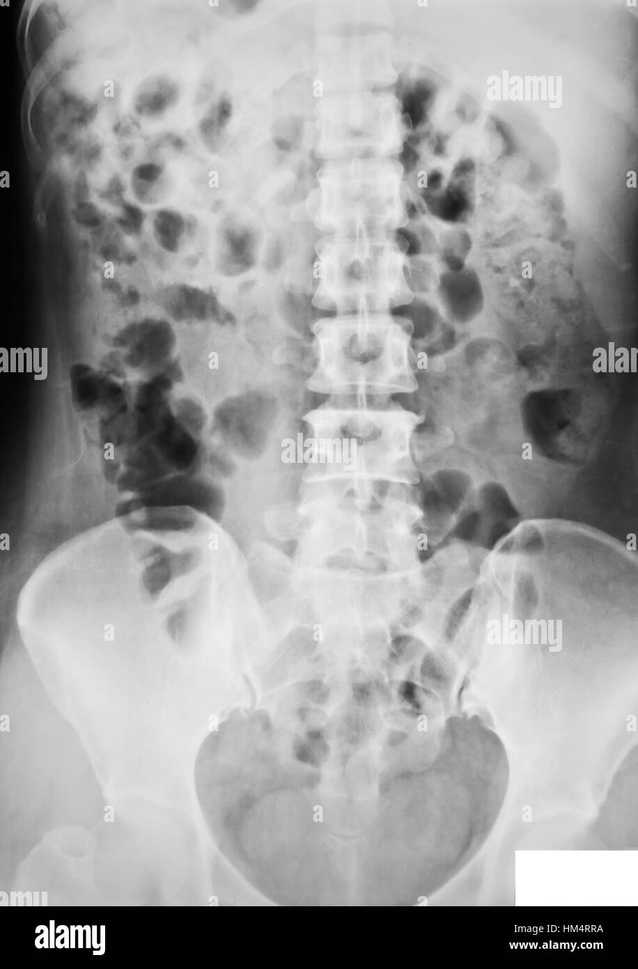 collection of xray Stock Photo Alamy