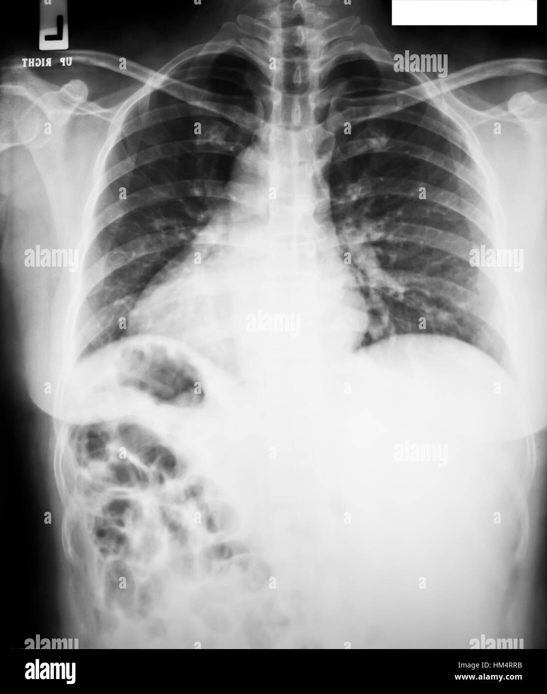 collection of xray Stock Photo Alamy