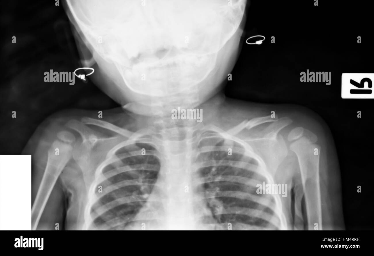 collection of xray Stock Photo Alamy