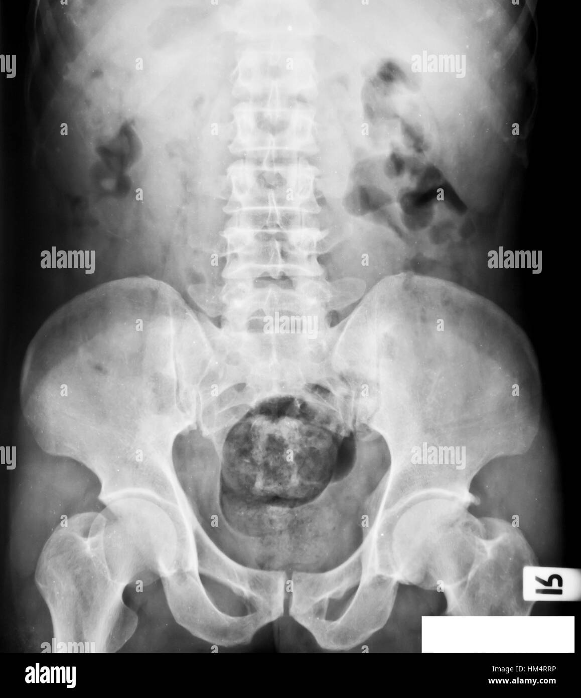 collection of xray Stock Photo Alamy