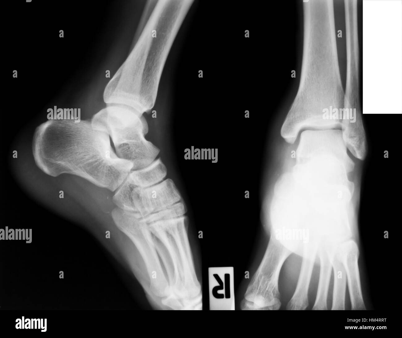 collection of xray Stock Photo Alamy