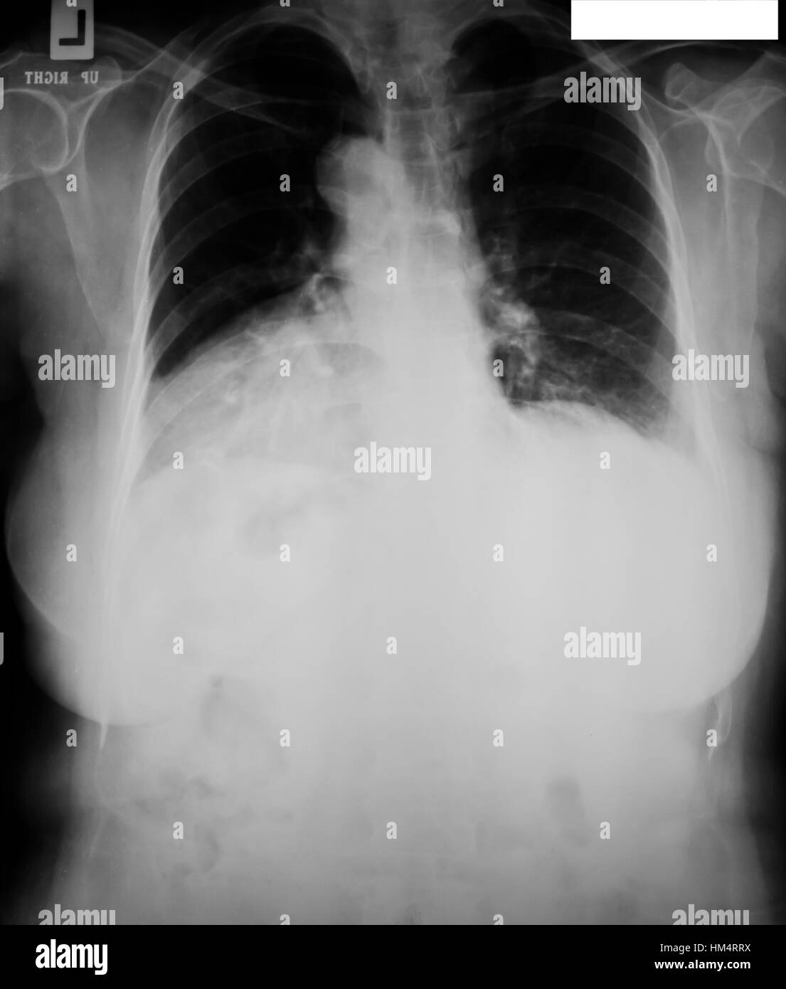 collection of xray Stock Photo Alamy