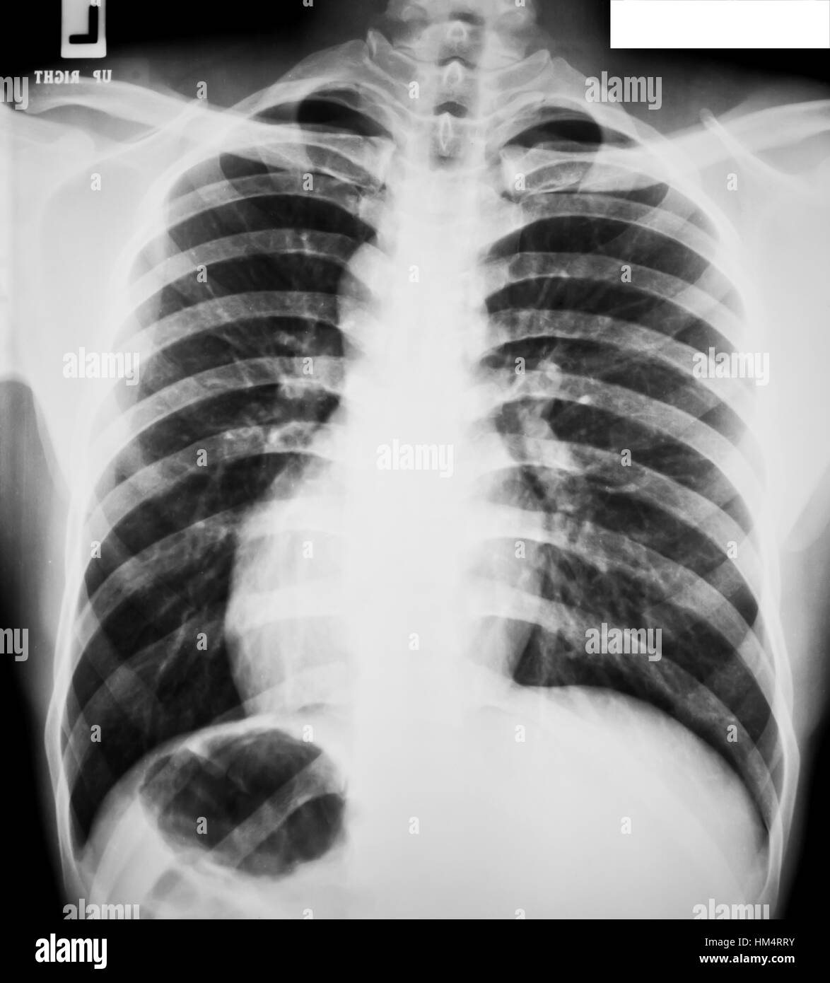 collection of xray Stock Photo Alamy