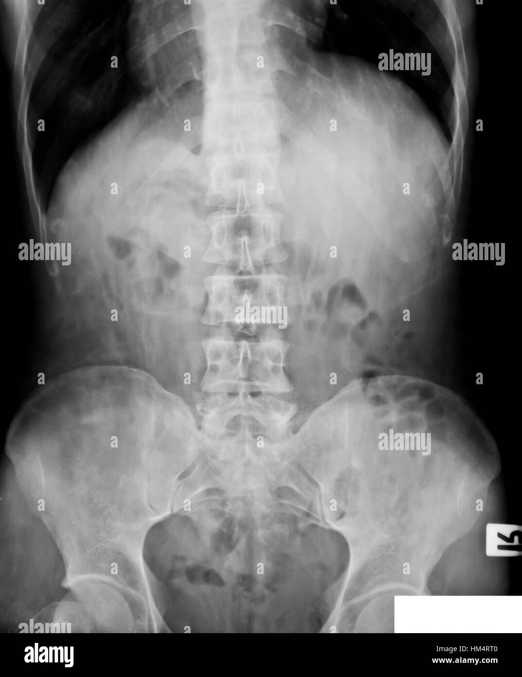 collection of xray Stock Photo Alamy