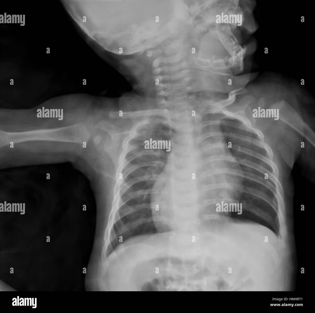 collection of xray Stock Photo Alamy