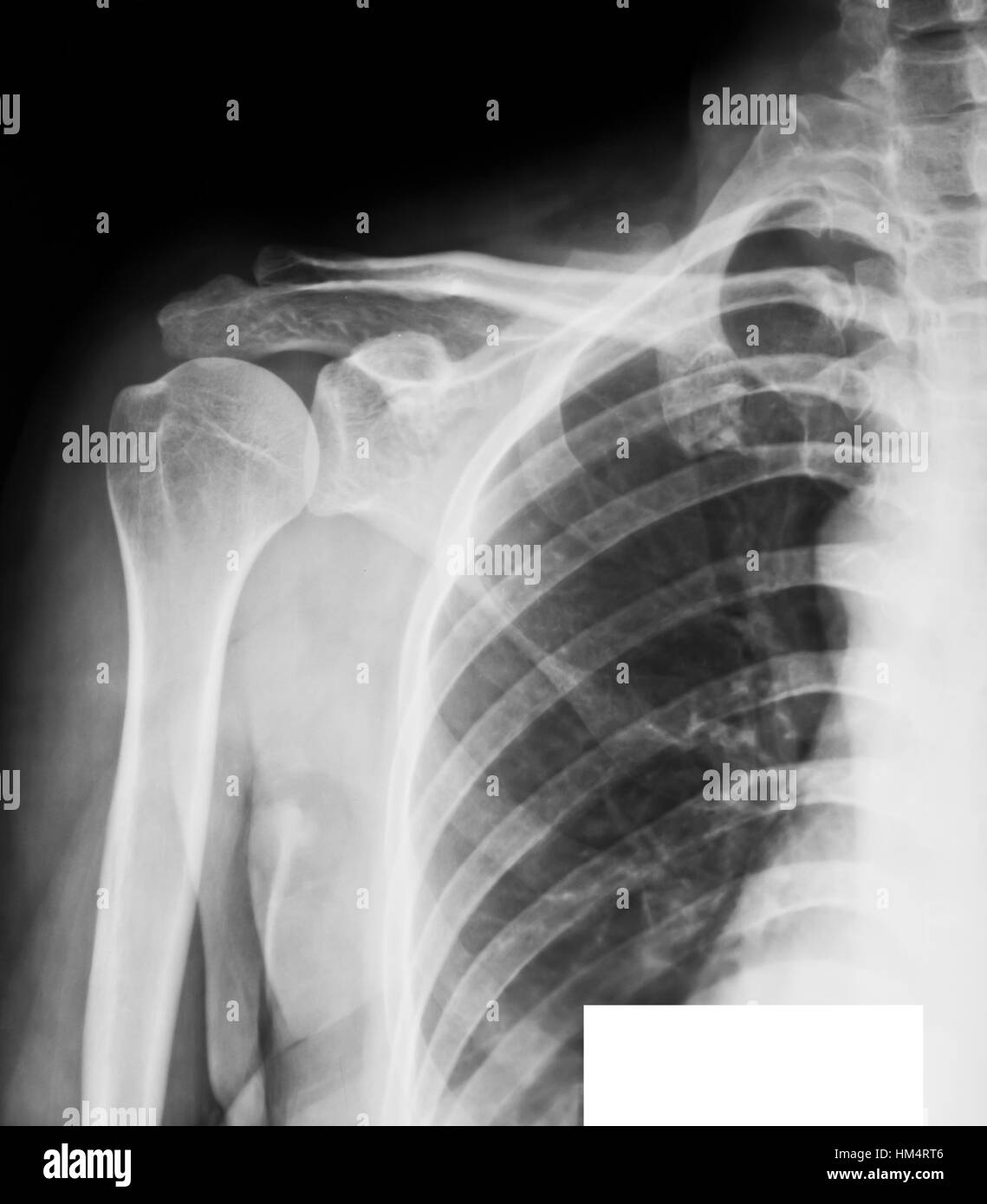 collection of xray Stock Photo Alamy