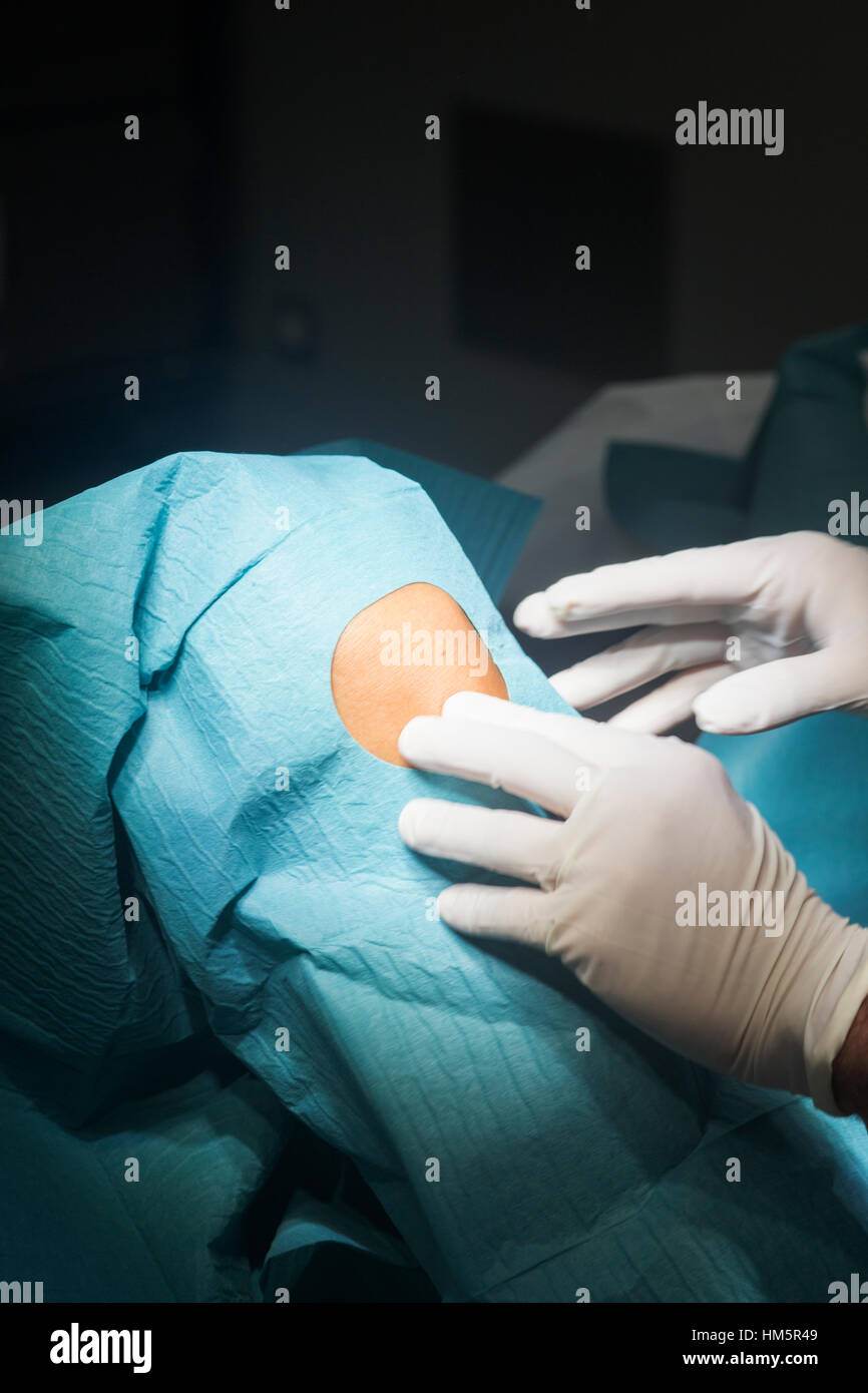 Preparing knee for surgery hospital operation medical procedure in emergency room operating theater. Stock Photo