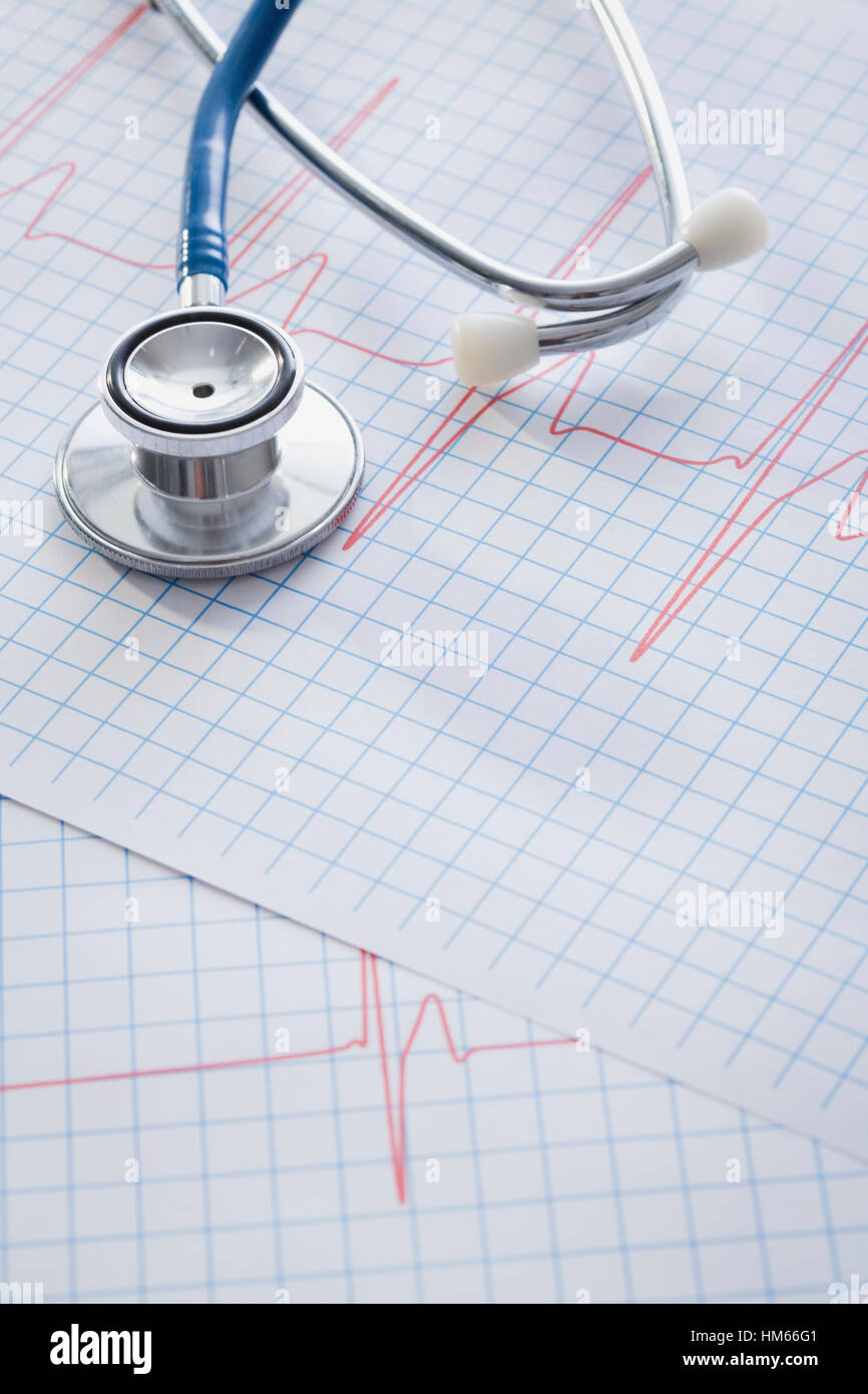 Stethoscope on paper with pulse trace Stock Photo