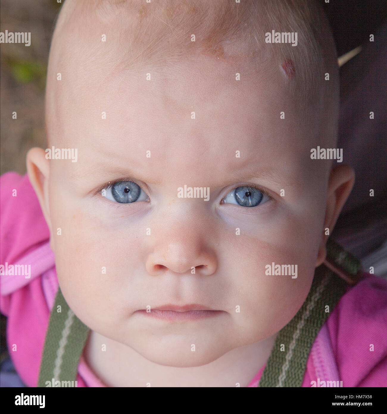 Close up portrait of baby girl with blue eyes and hemangioma Stock Photo