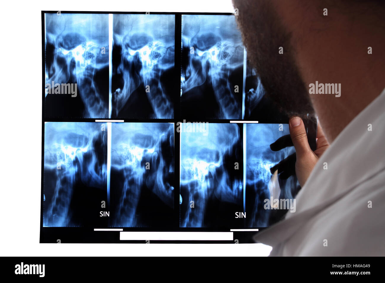 Cervical spine mri hi-res stock photography and images - Alamy