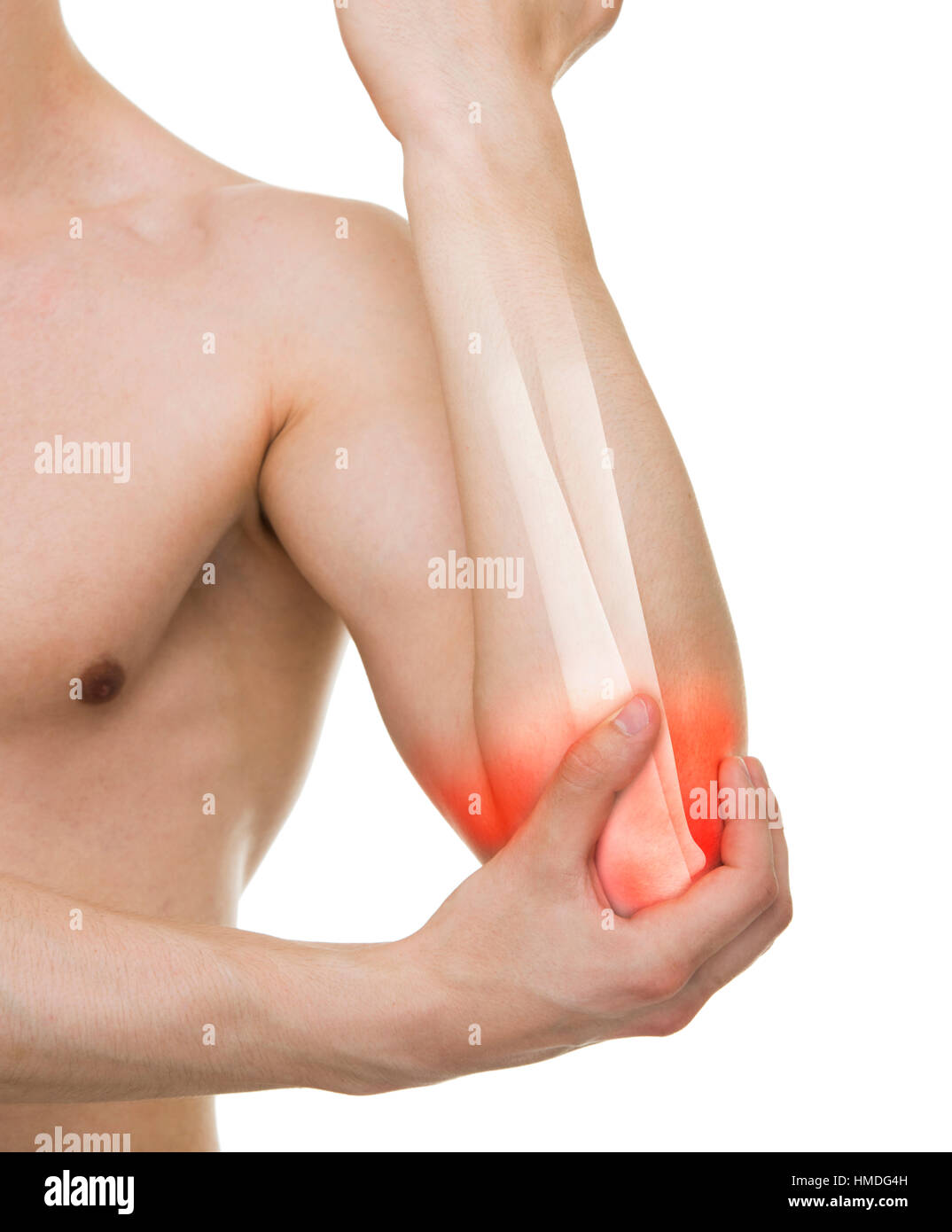 Man Elbow Injured - Studio shot with 3D illustration isolated on white Stock Photo
