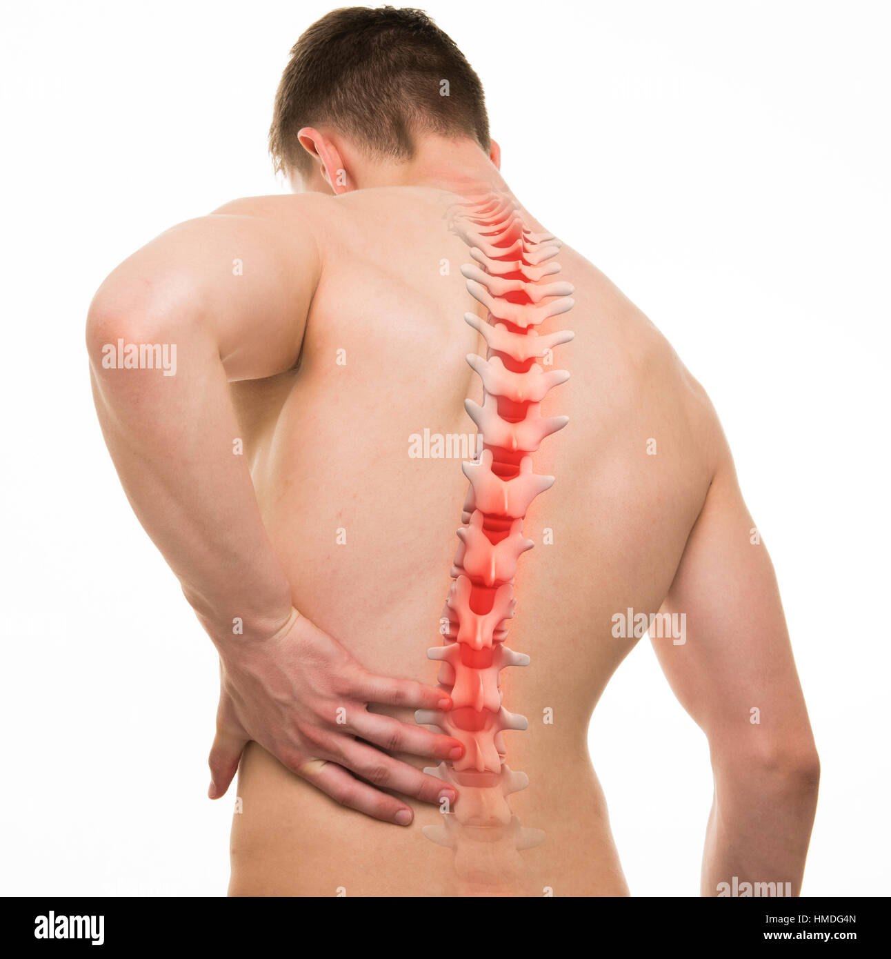 Spinal Pain - Studio shot with 3D illustration isolated on white Stock Photo