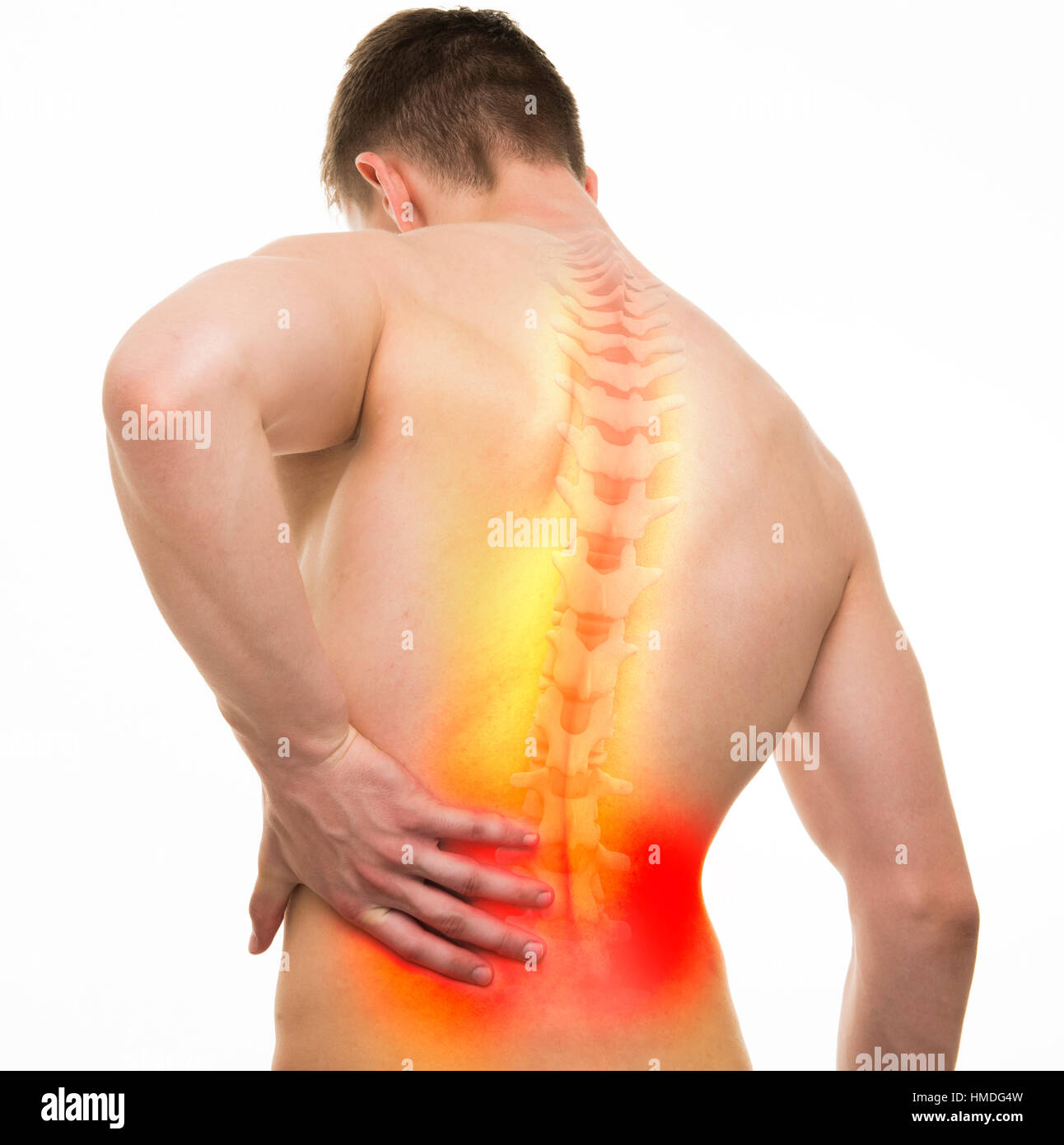 Back Injury Male Anatomy - Studio shot with 3D illustration isolated on white Stock Photo