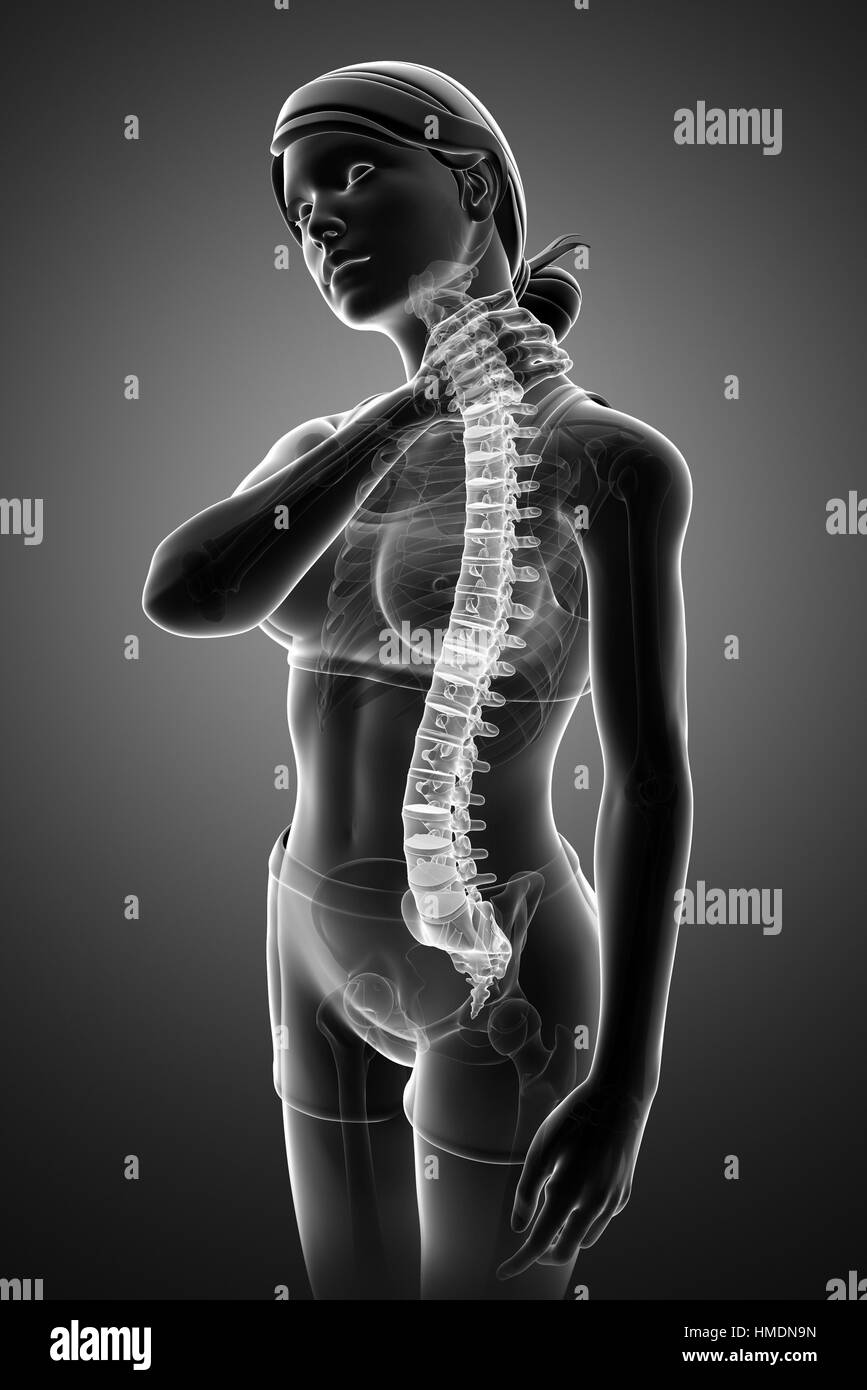 3d Illustration of Women Feeling the Back pain Stock Photo