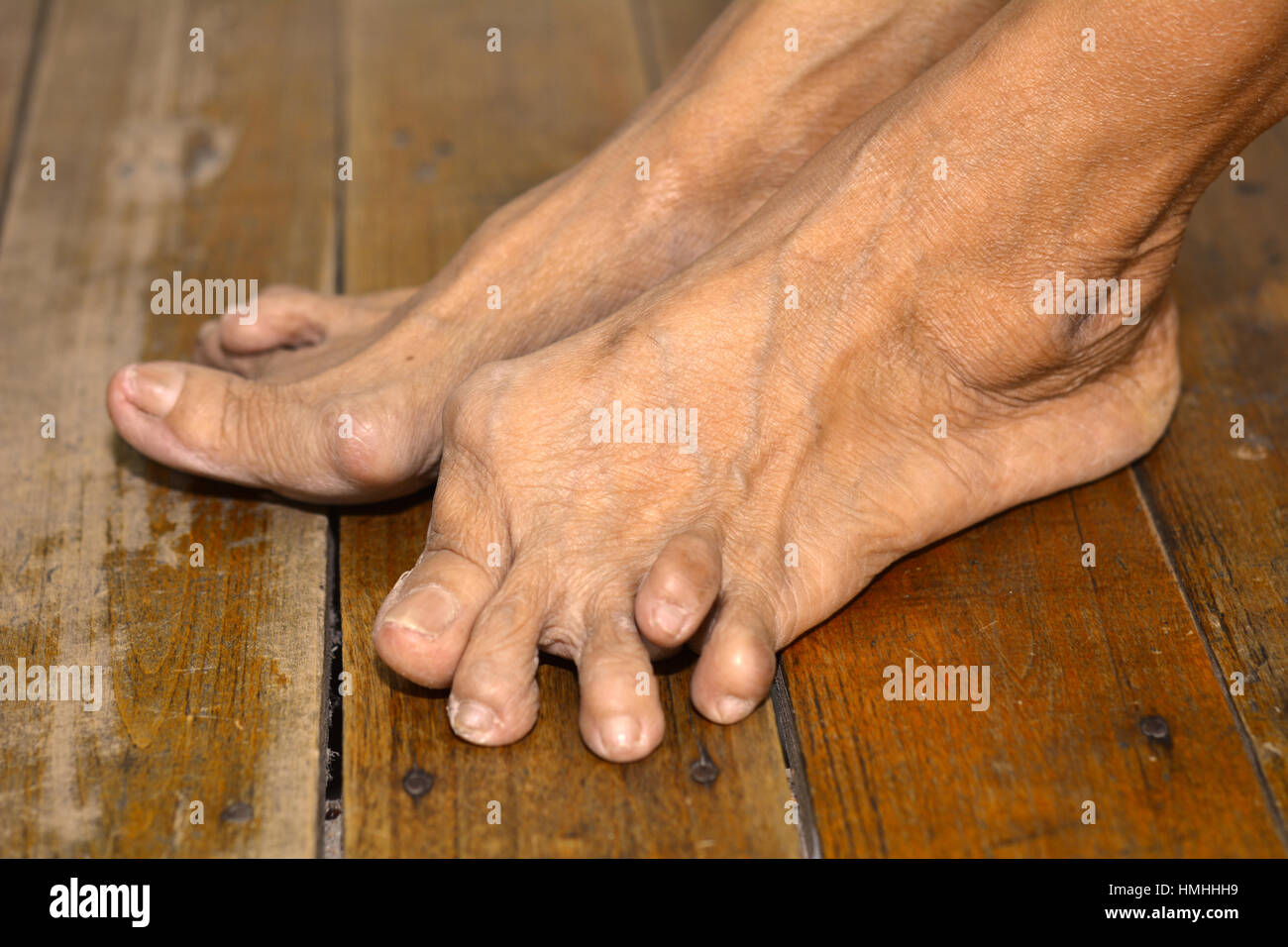 1174 Old Lady Feet Stock Photos & High-res Pictures