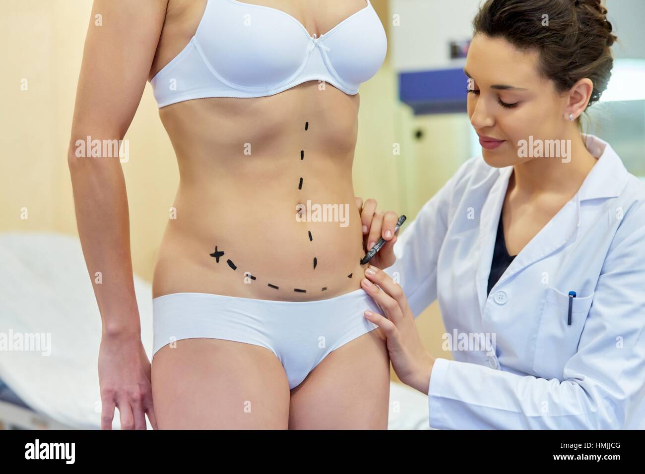 Abdomen. Tummy tuck. It is retensioning skin and abdominal muscles, by removing redundant skin and musculature plication. Before surgery should be Stock Photo