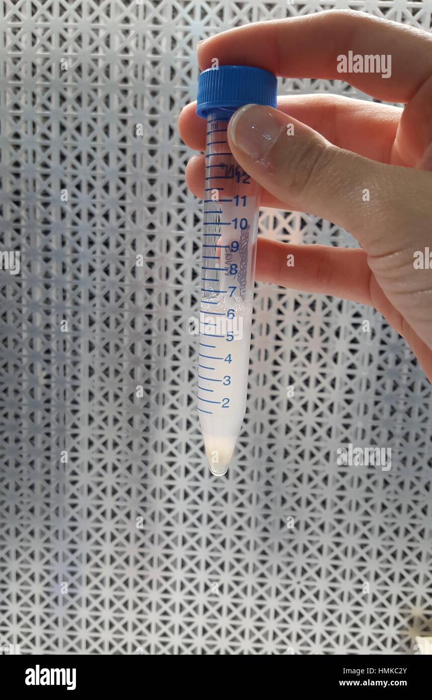 Sperm hires stock photography and images Alamy