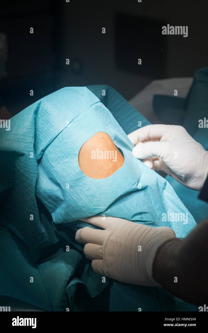 Preparing knee for surgery hospital operation medical procedure in emergency room operating theater. Stock Photo