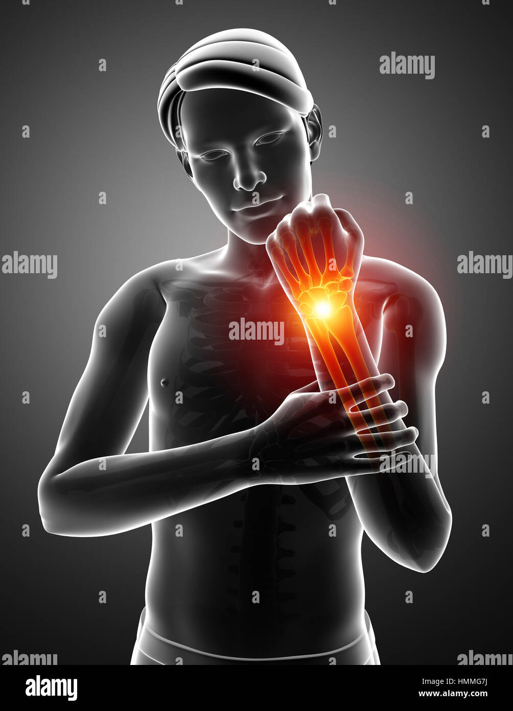 human body anatomy with joint pain Stock Photo Alamy