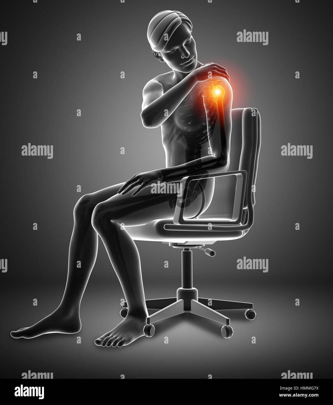 Human body anatomy inflammation x ray hi-res stock photography and ...