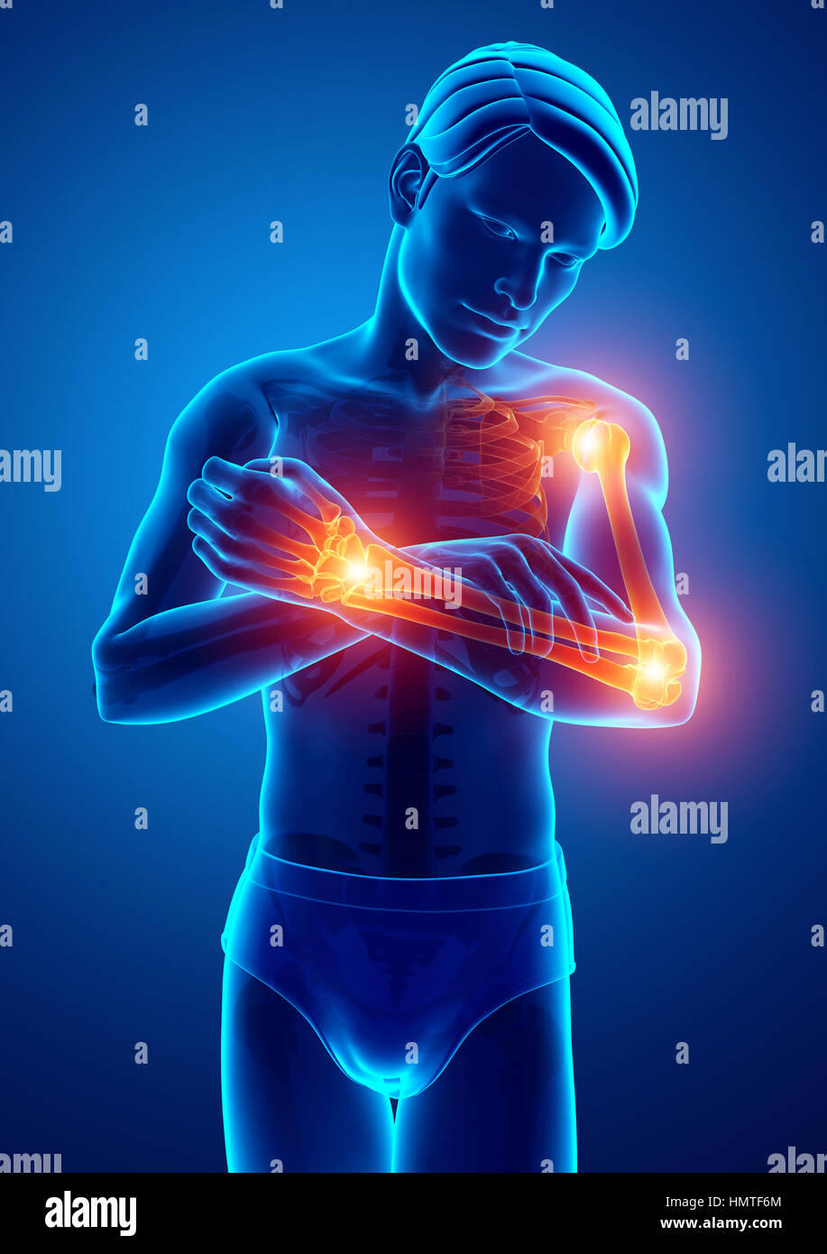 3d Illustration of Men Feeling Arm joint pain Stock Photo Alamy